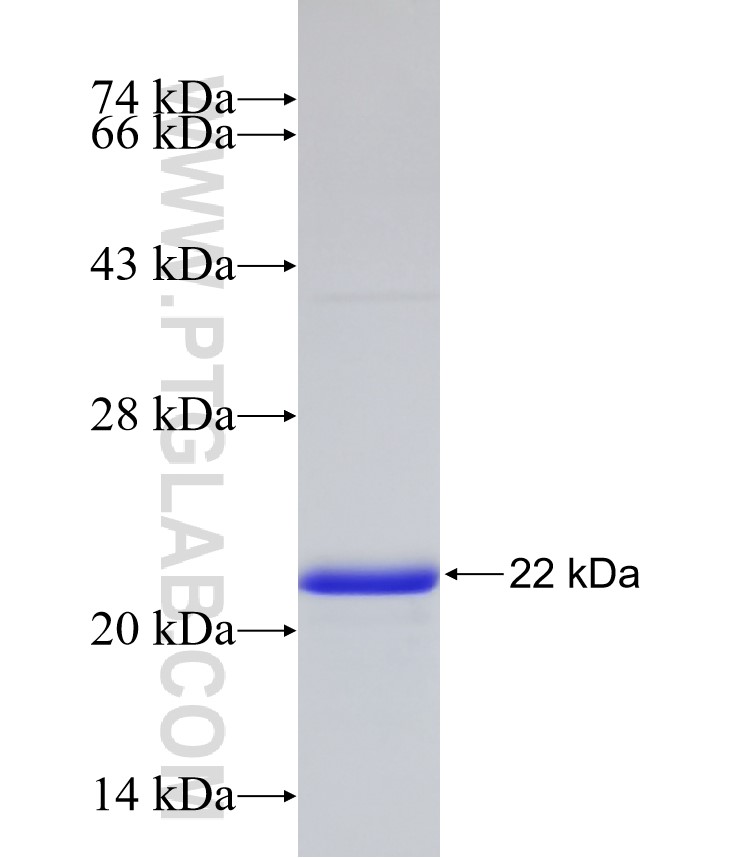 CYBRD1 fusion protein Ag24968 SDS-PAGE