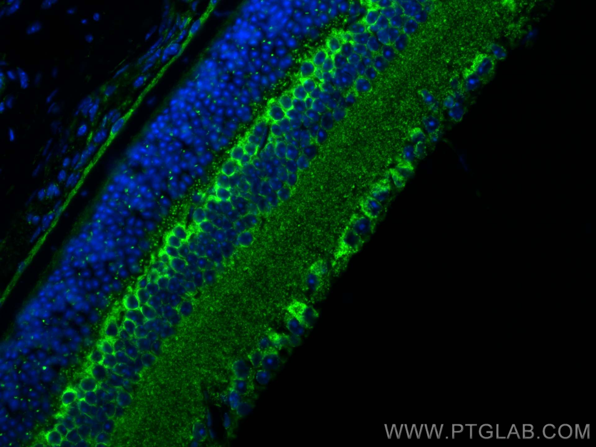 IF Staining of mouse eye using 10993-1-AP