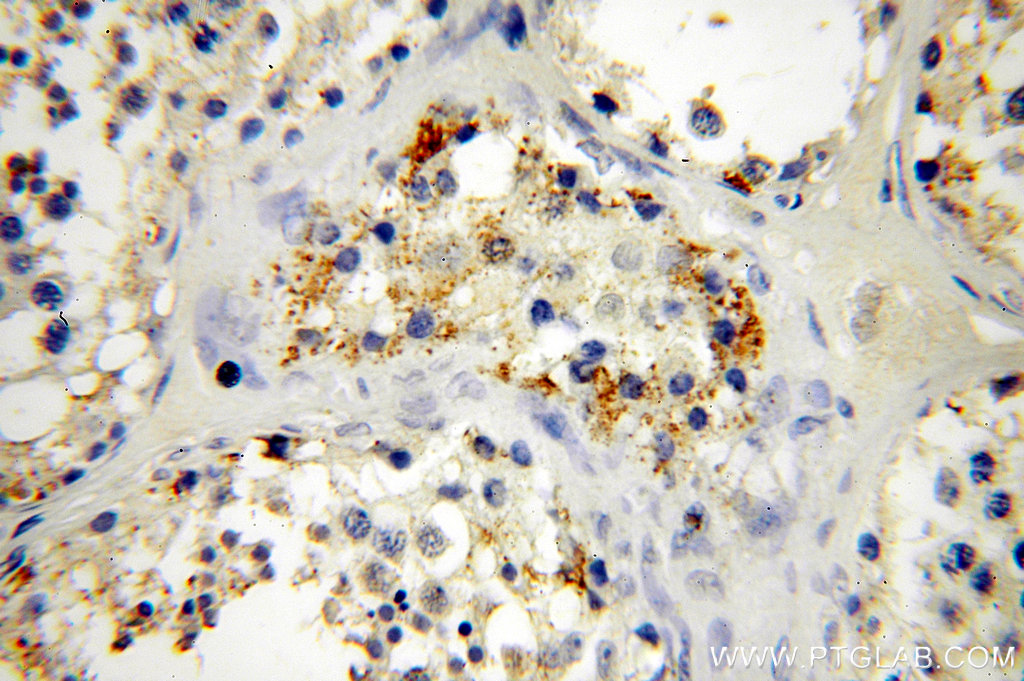 IHC staining of human testis using 18729-1-AP