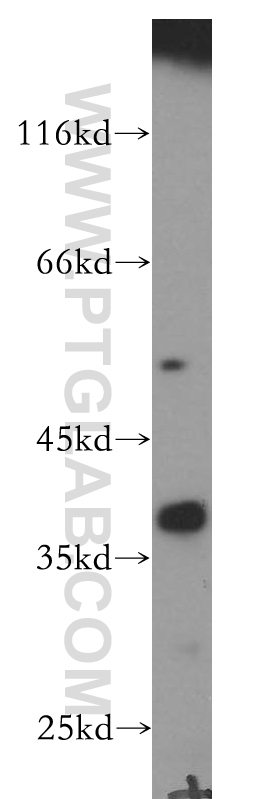 WB analysis of human adrenal gland using 18729-1-AP