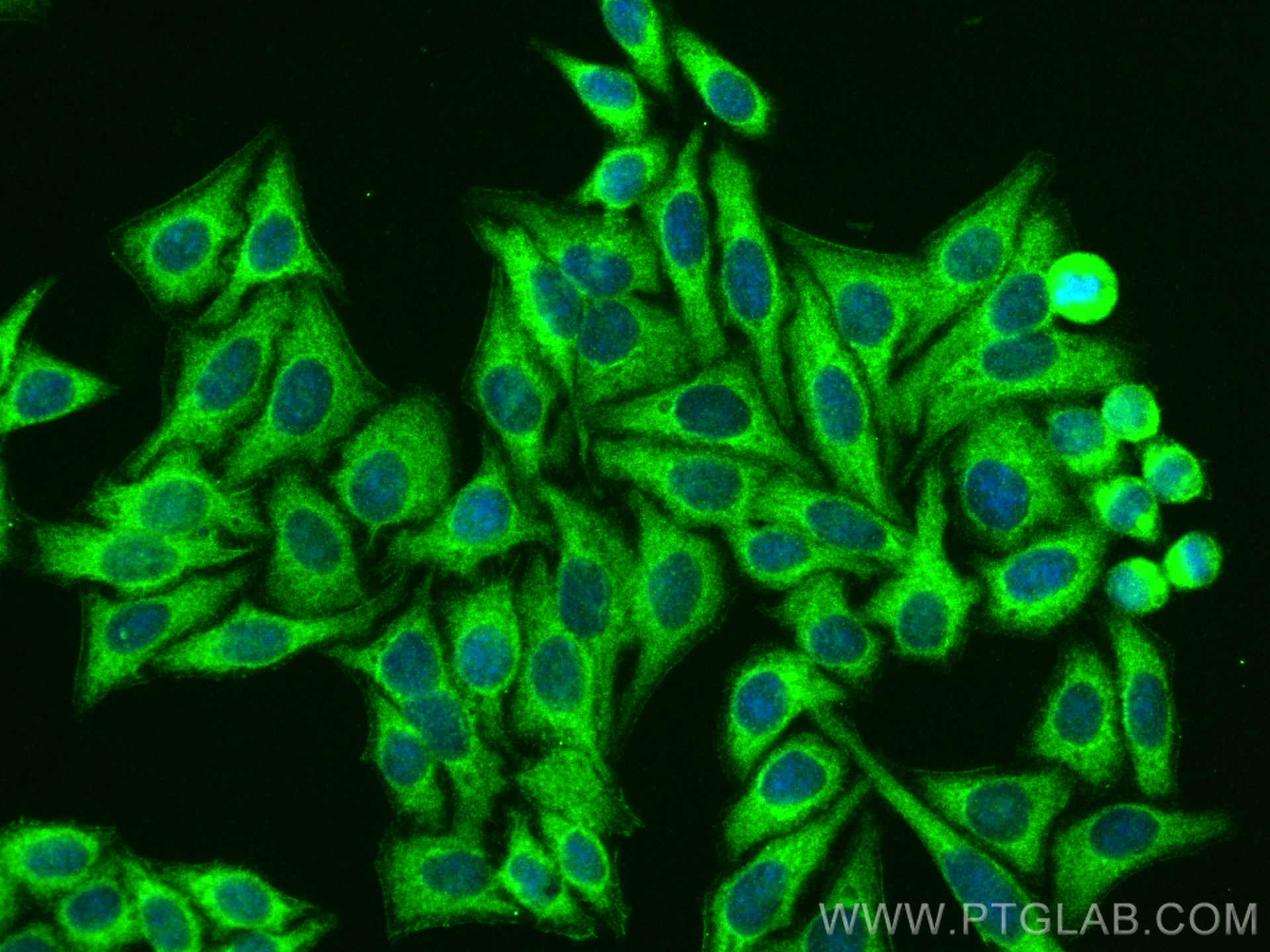 IF Staining of HepG2 using 13363-1-AP