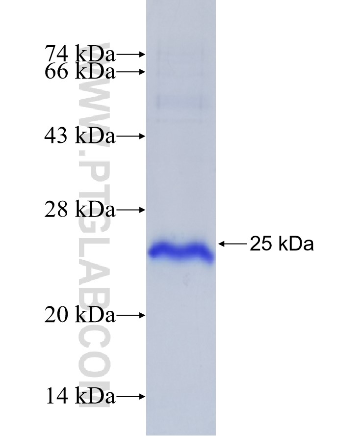 CYP19A1 fusion protein Ag29020 SDS-PAGE