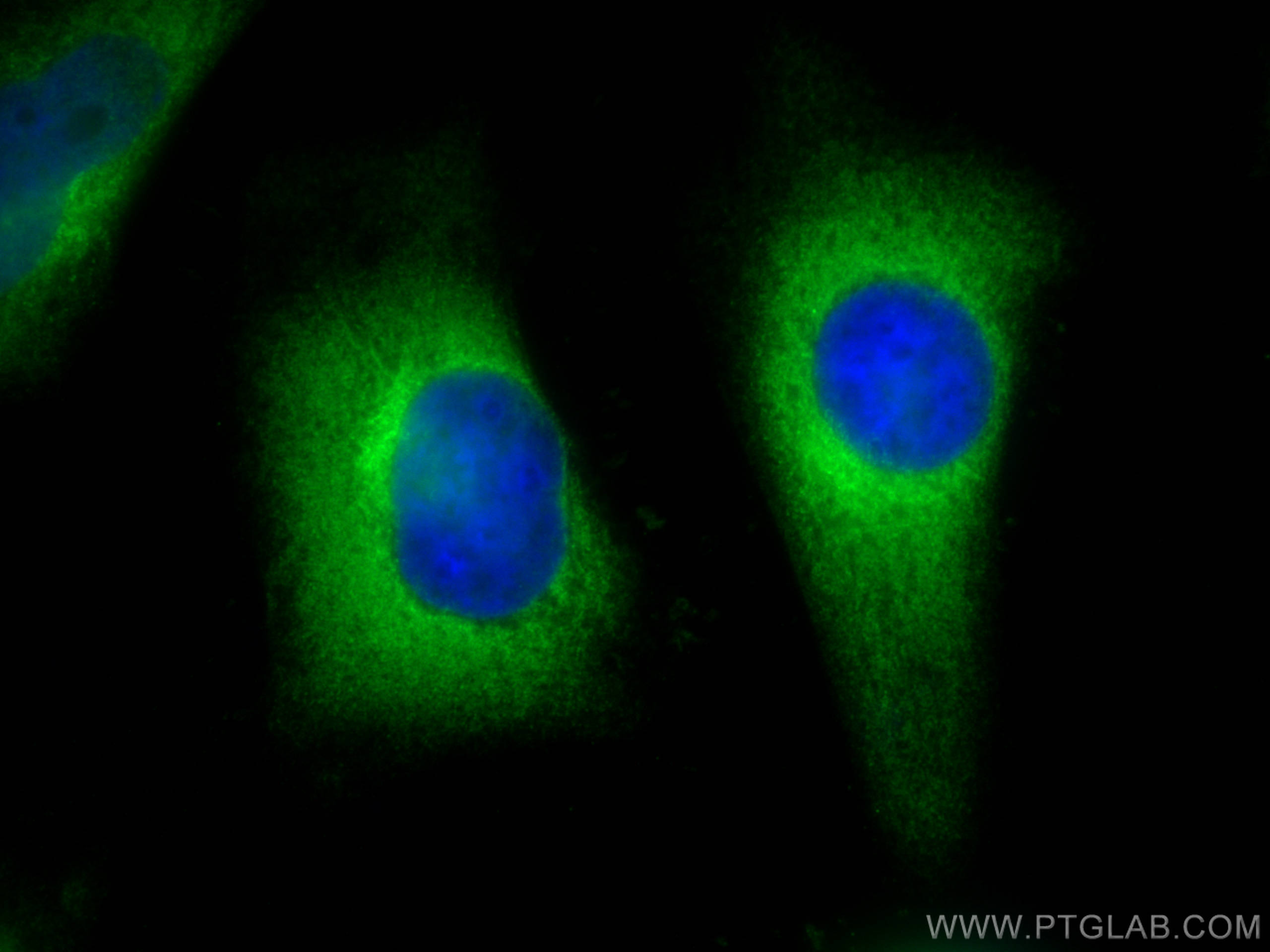 IF Staining of HeLa using 13241-1-AP