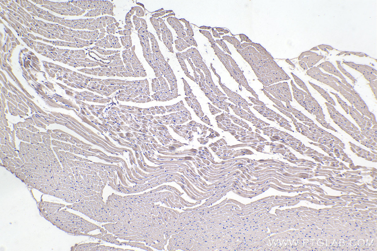 IHC staining of mouse heart using 67033-1-Ig (same clone as 67033-1-PBS)