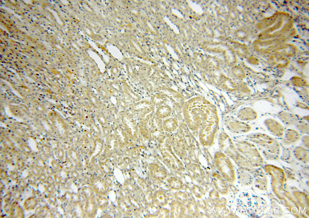 IHC staining of human kidney using 19195-1-AP