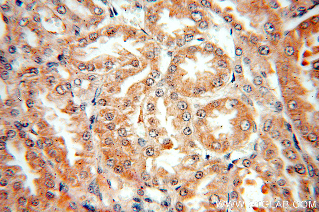 IHC staining of human kidney using 19195-1-AP