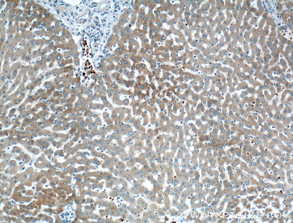 IHC staining of human liver using 21721-1-AP