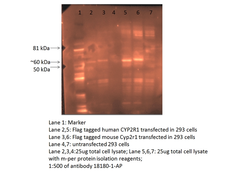 WB analysis of transfected cells using 18180-1-AP