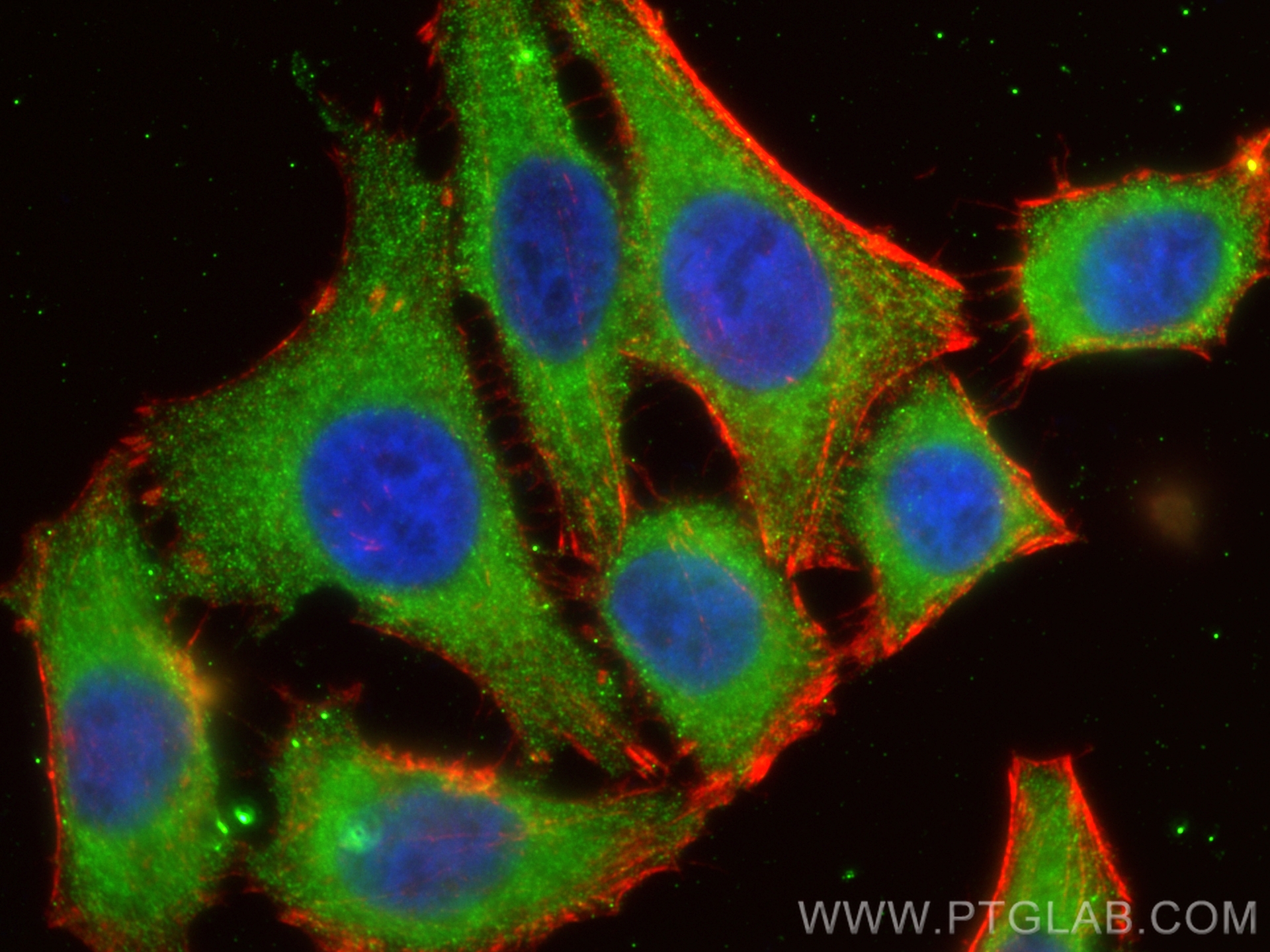 IF Staining of HepG2 using 67419-1-Ig (same clone as 67419-1-PBS)