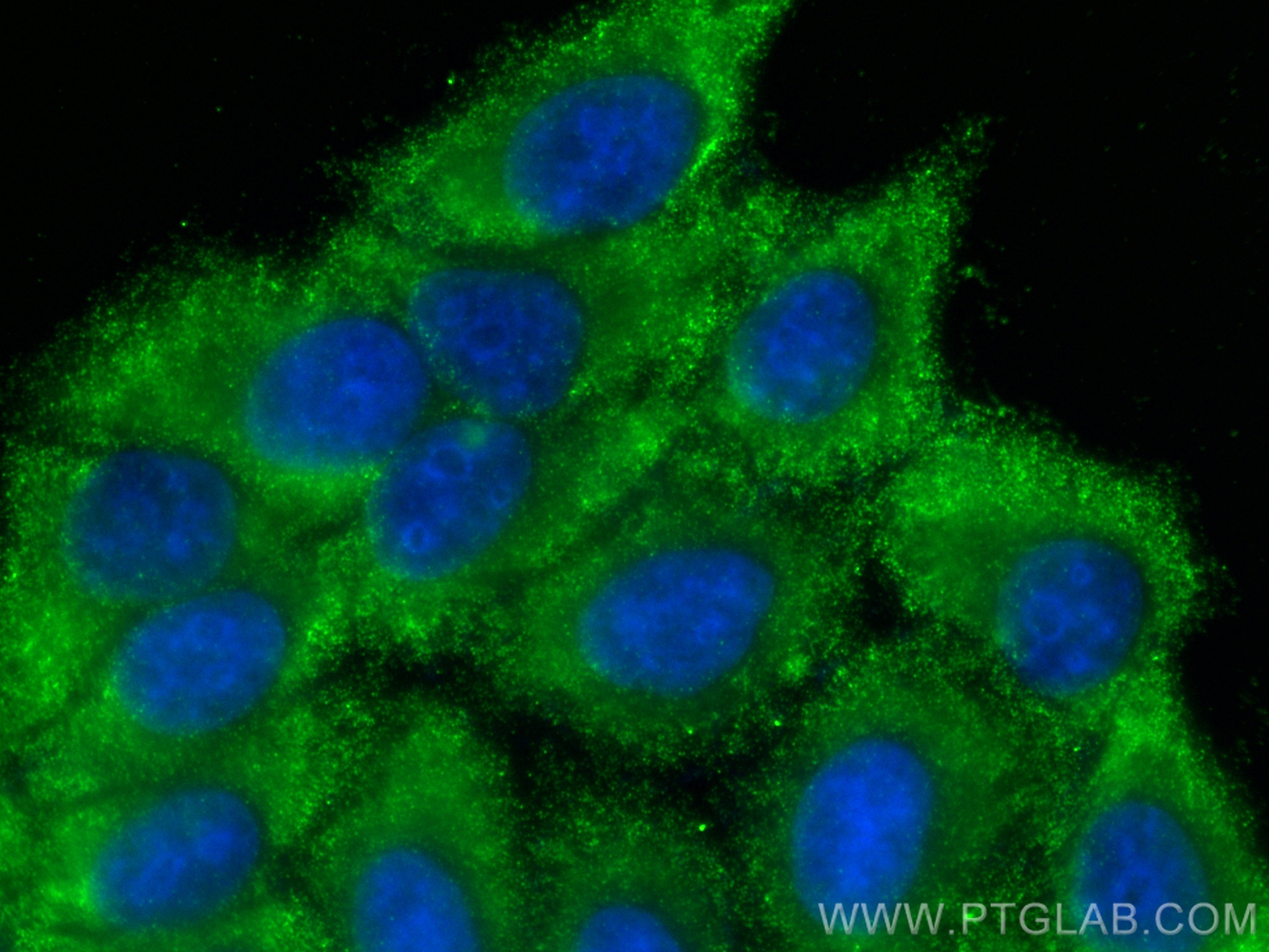 IF Staining of HepG2 using 67110-1-Ig