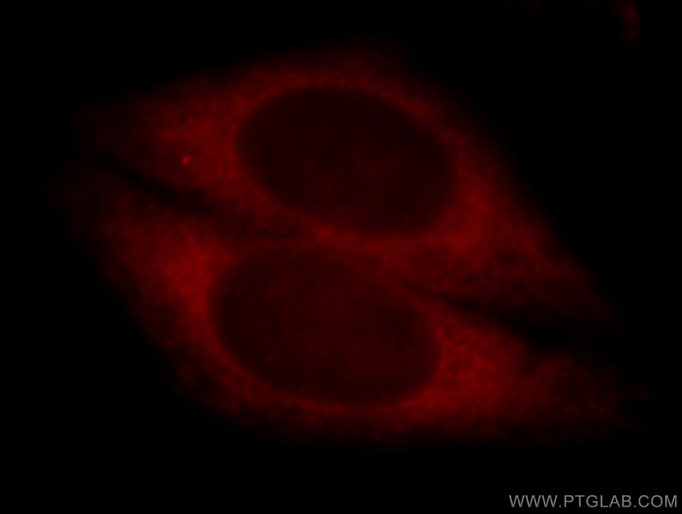 IF Staining of HepG2 using 20012-1-AP