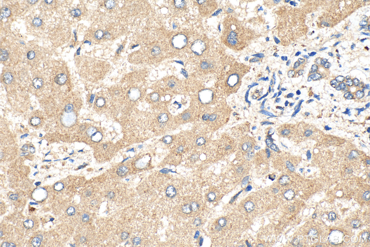 IHC staining of human liver using 20010-1-AP