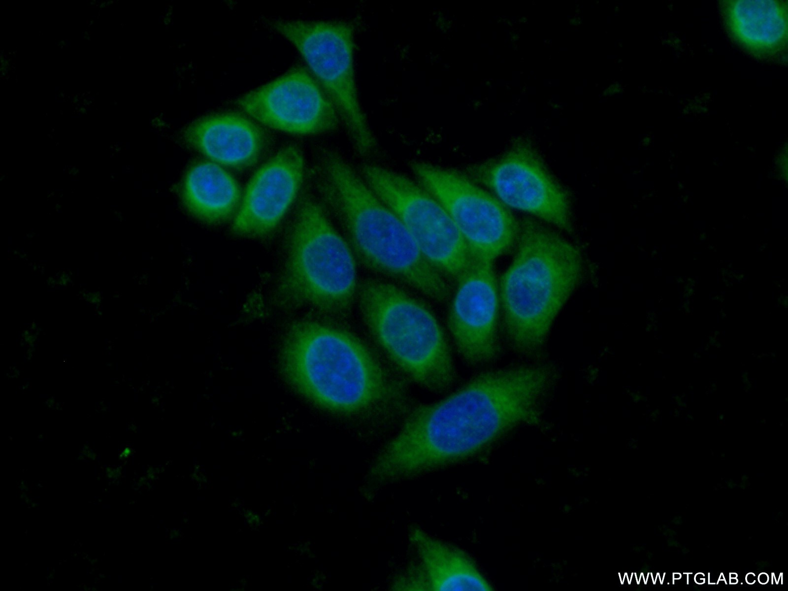 IF Staining of PC-3 using 13431-1-AP