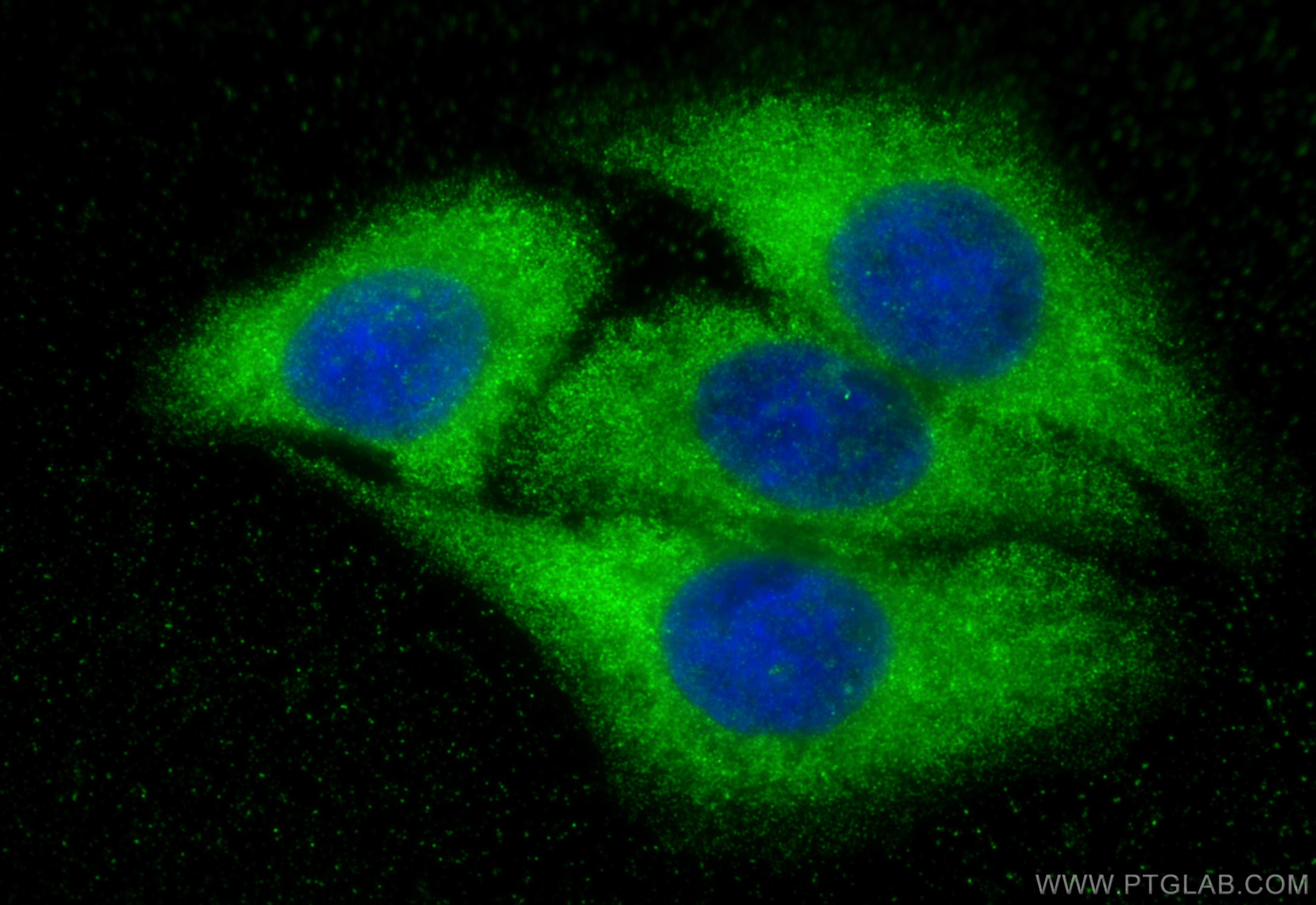 IF Staining of HepG2 using 18054-1-AP