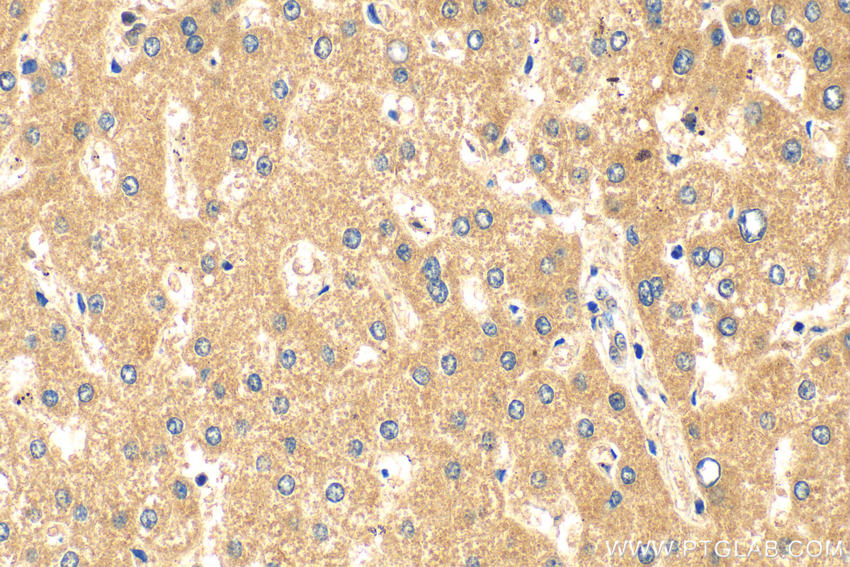 IHC staining of human liver using 18054-1-AP