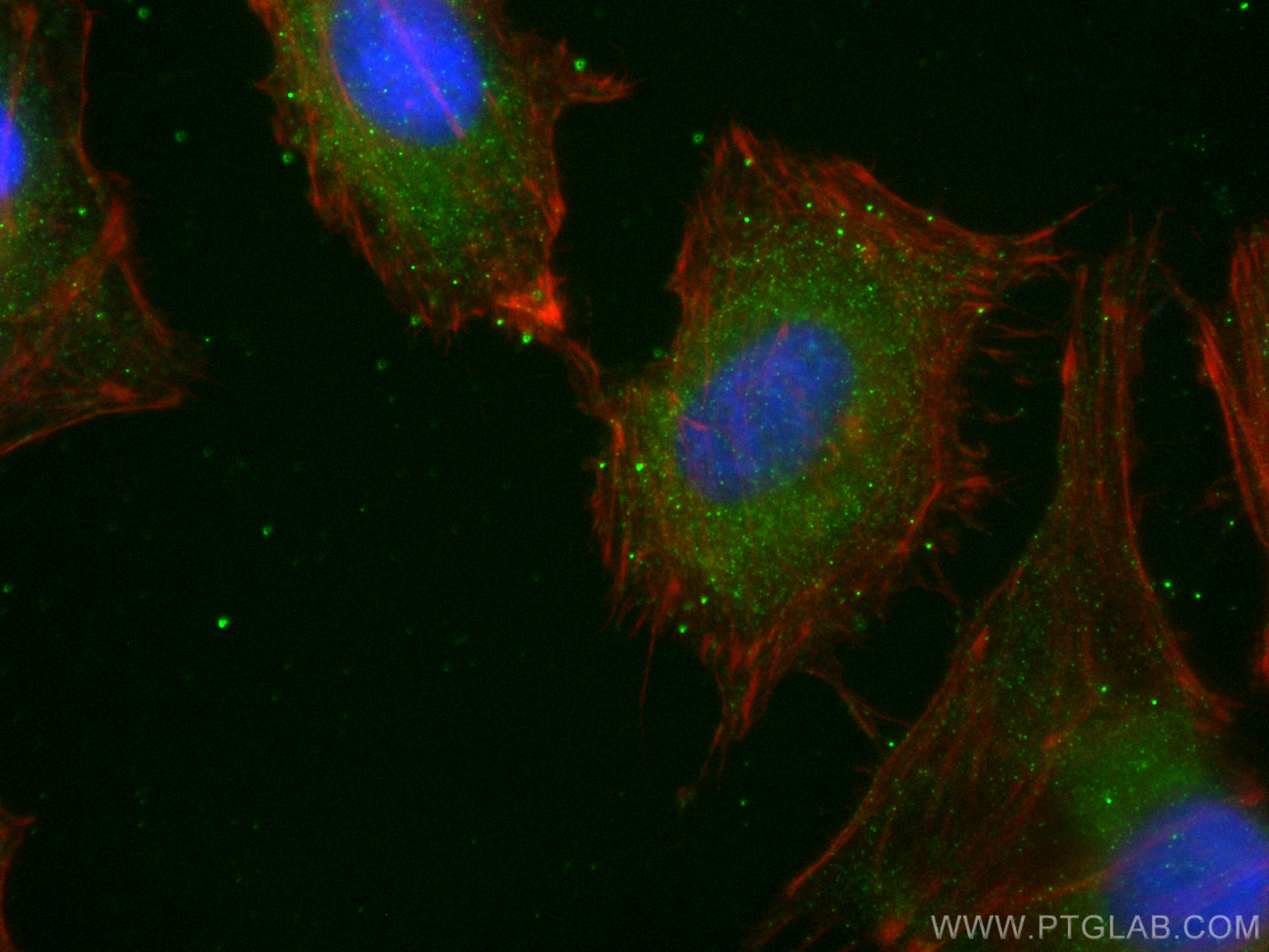 IF Staining of HeLa using 82927-2-RR (same clone as 82927-2-PBS)