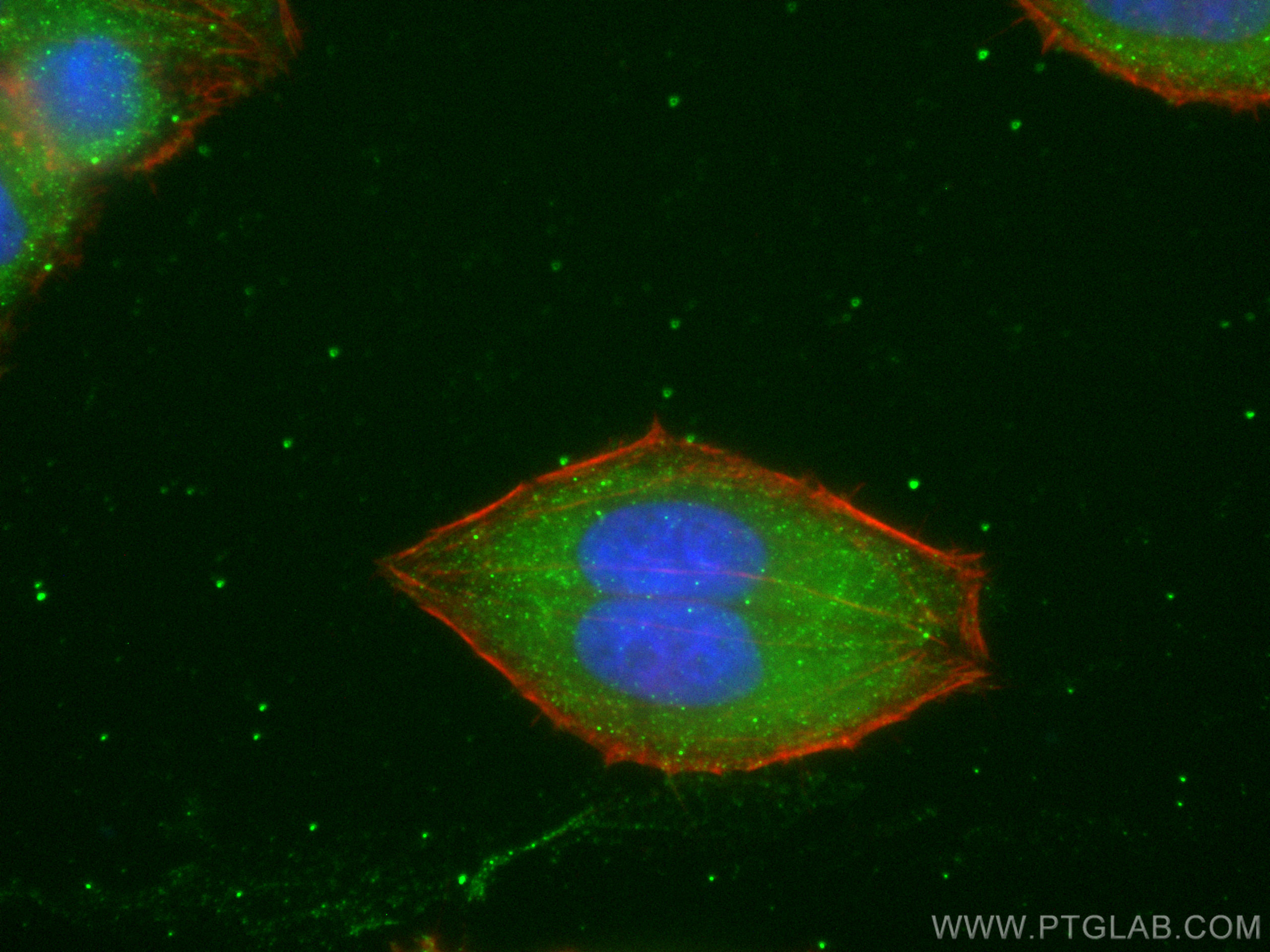 IF Staining of HepG2 using 82927-2-RR (same clone as 82927-2-PBS)