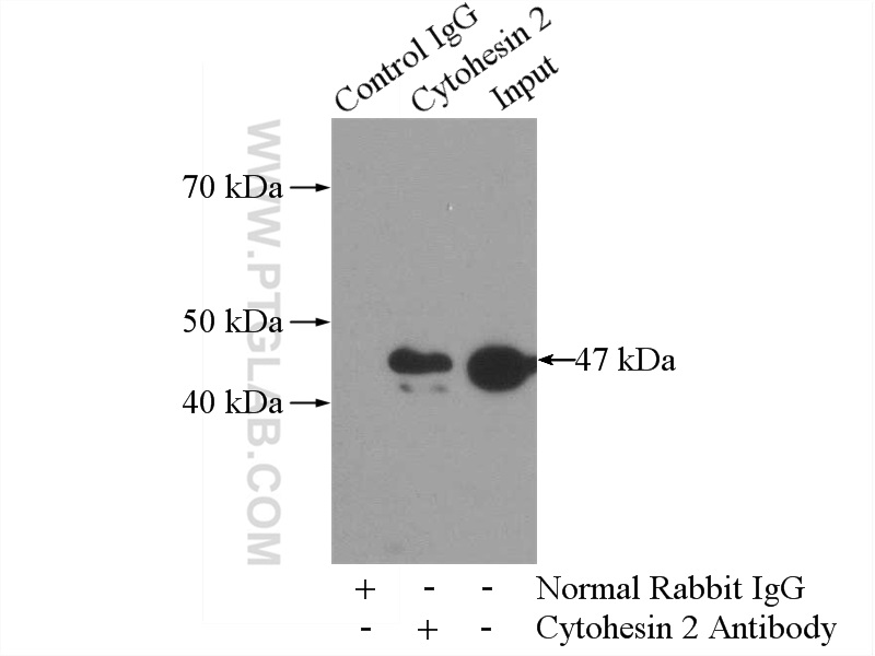 IP experiment of mouse heart using 10405-1-AP