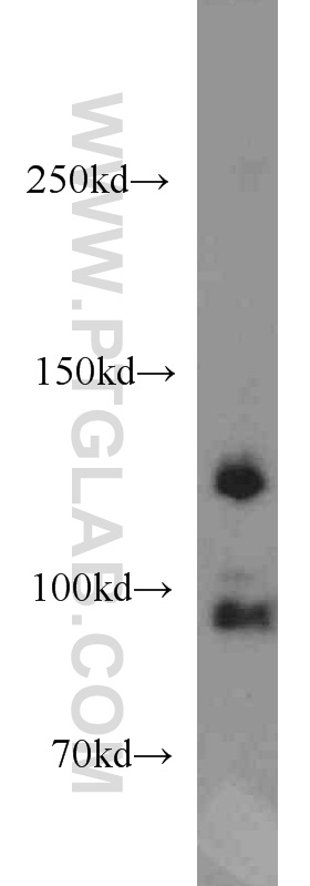 WB analysis of mouse kidney using 13851-1-AP