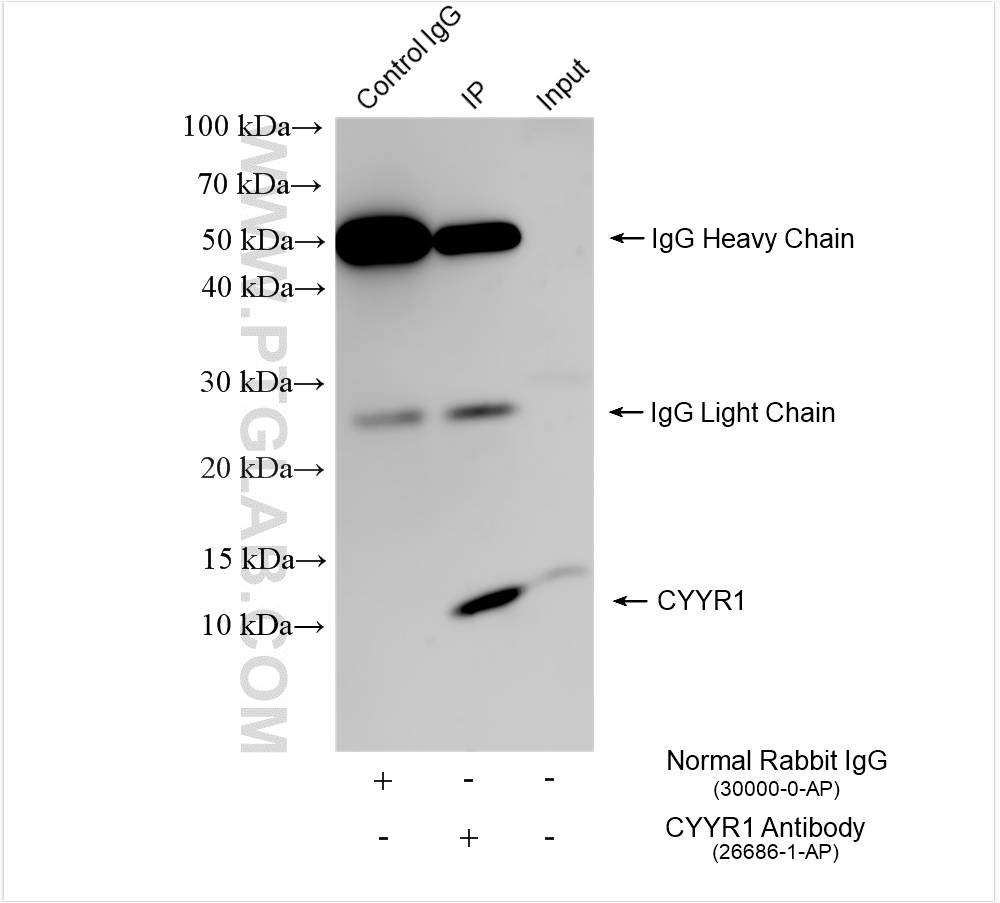 CYYR1