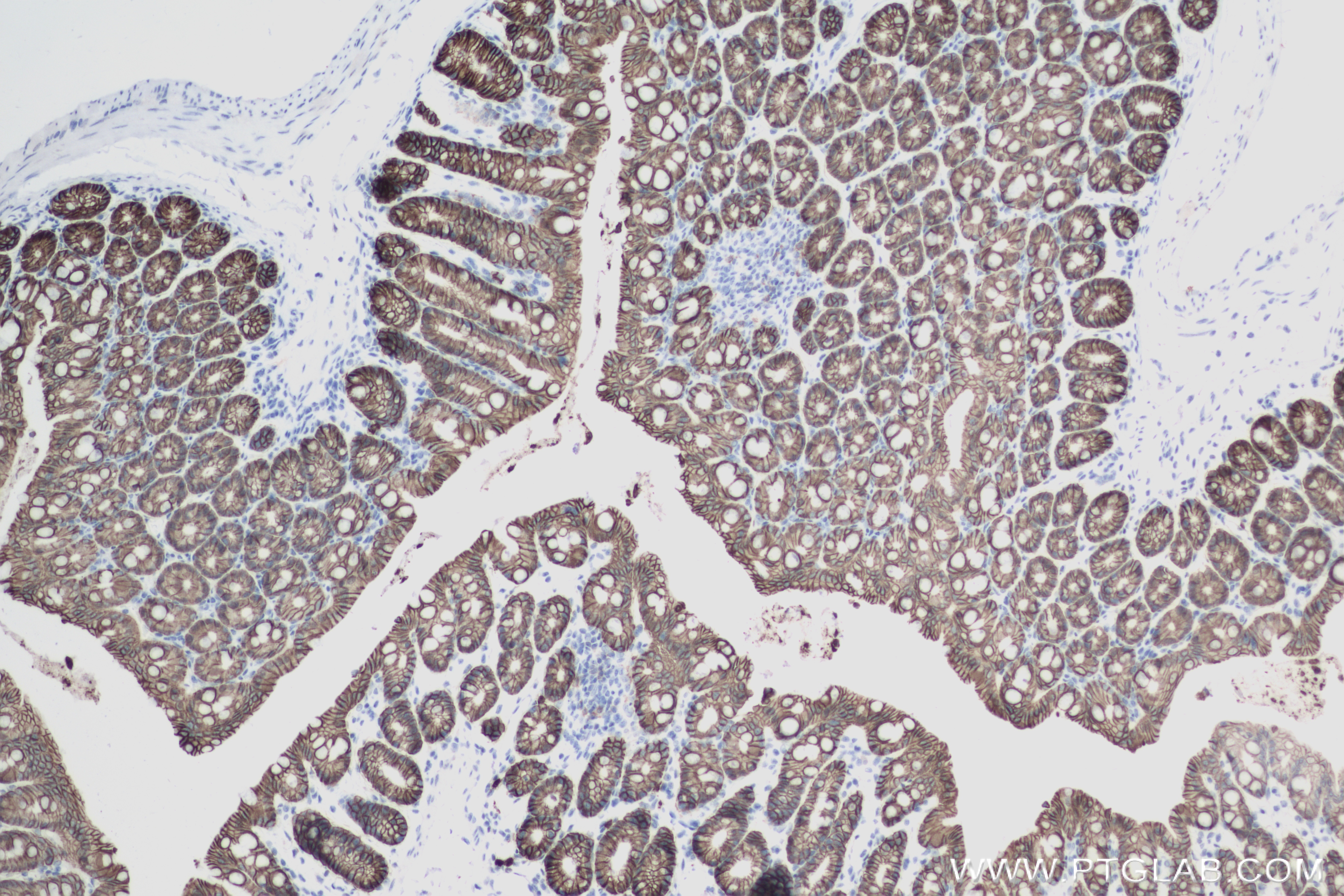 IHC staining of mouse colon using 83793-5-RR