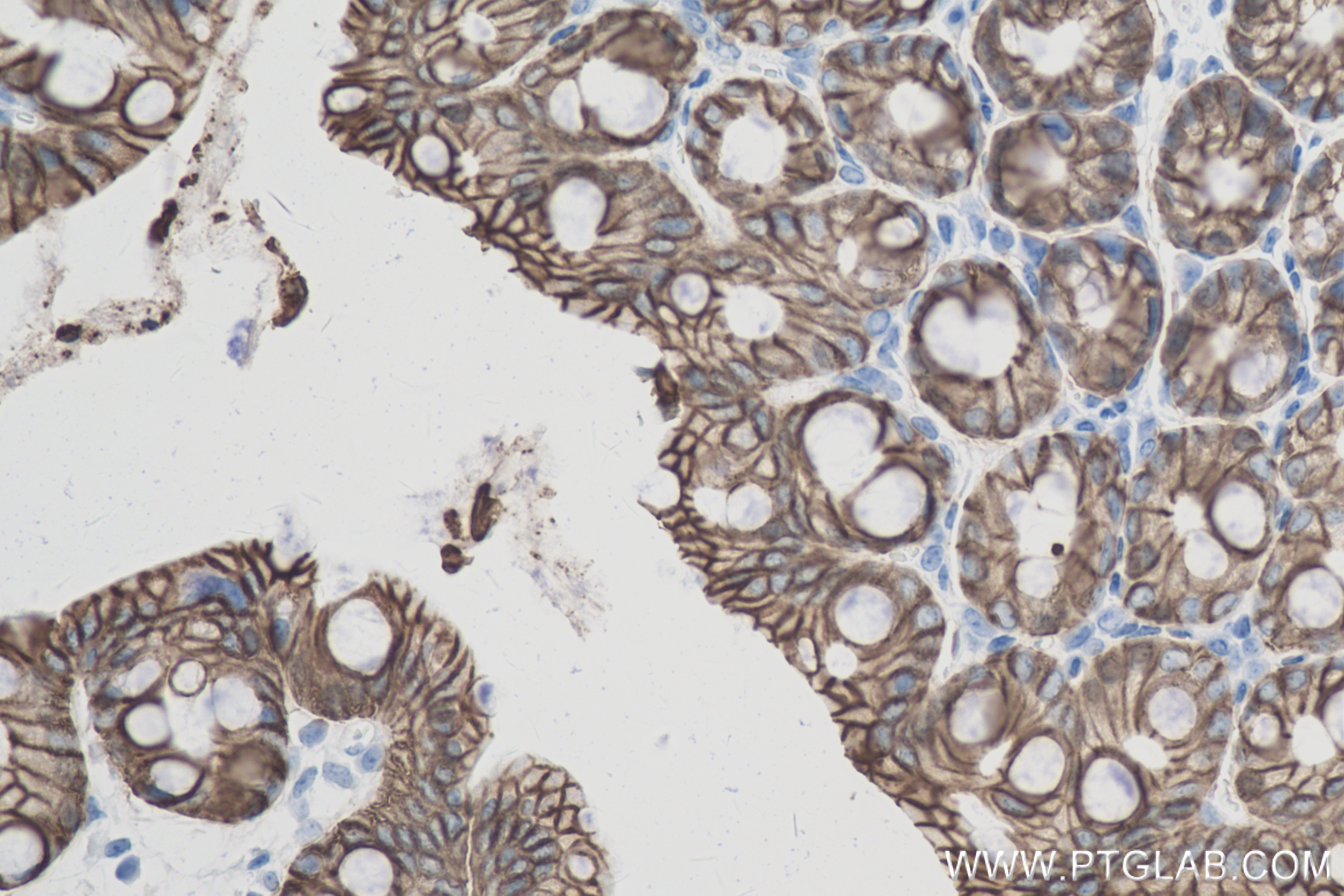 IHC staining of mouse colon using 83793-5-RR