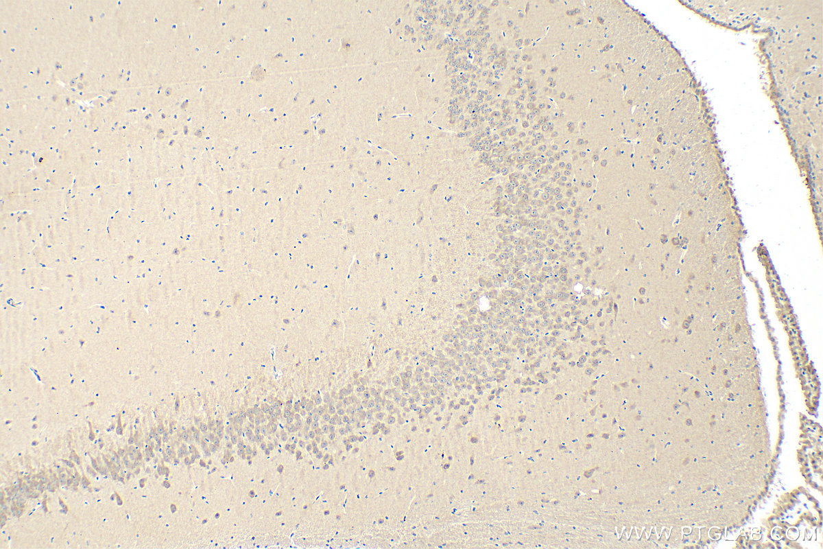 IHC staining of mouse brain using 28270-1-AP