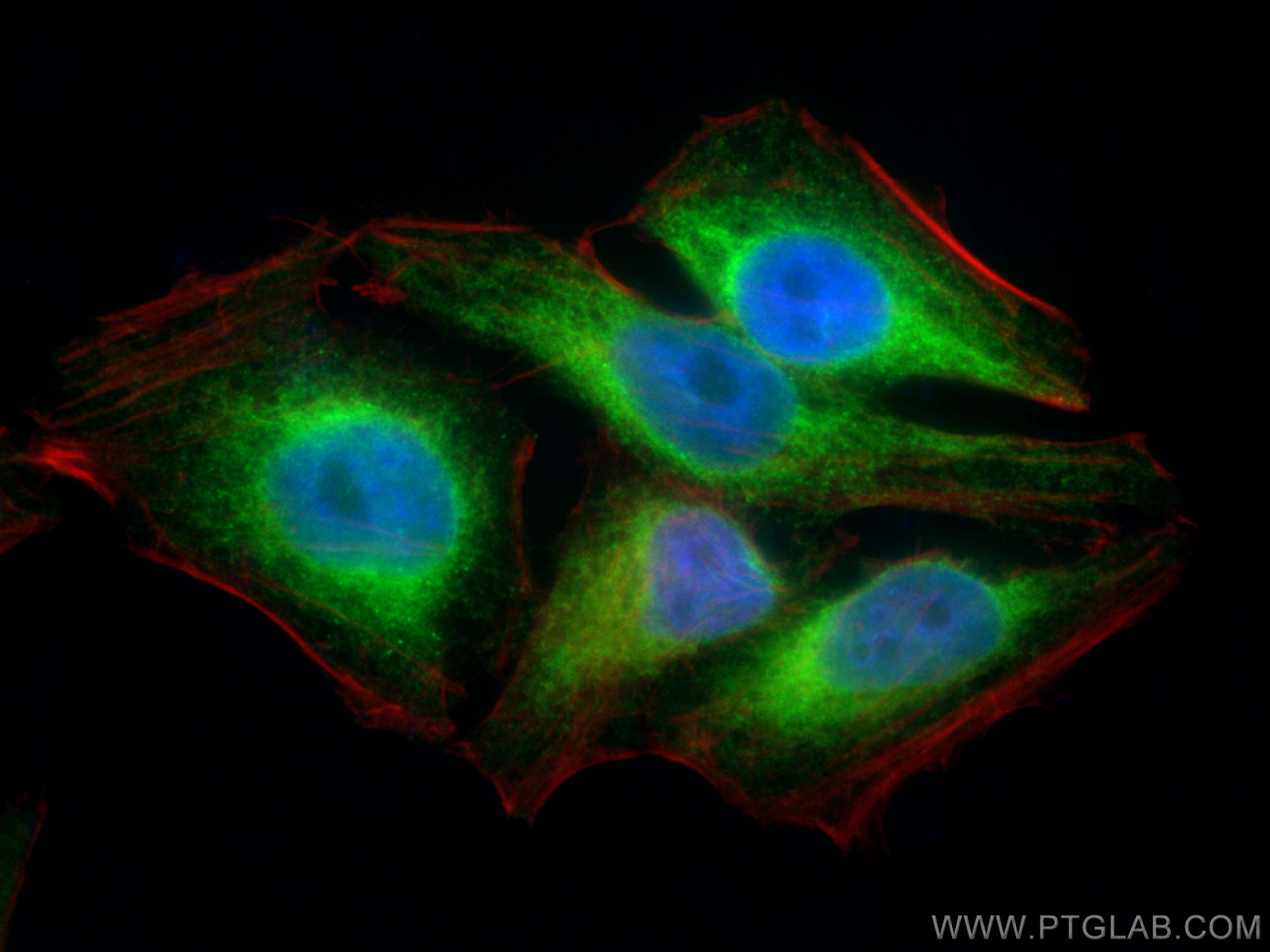 IF Staining of HepG2 using CL488-10427