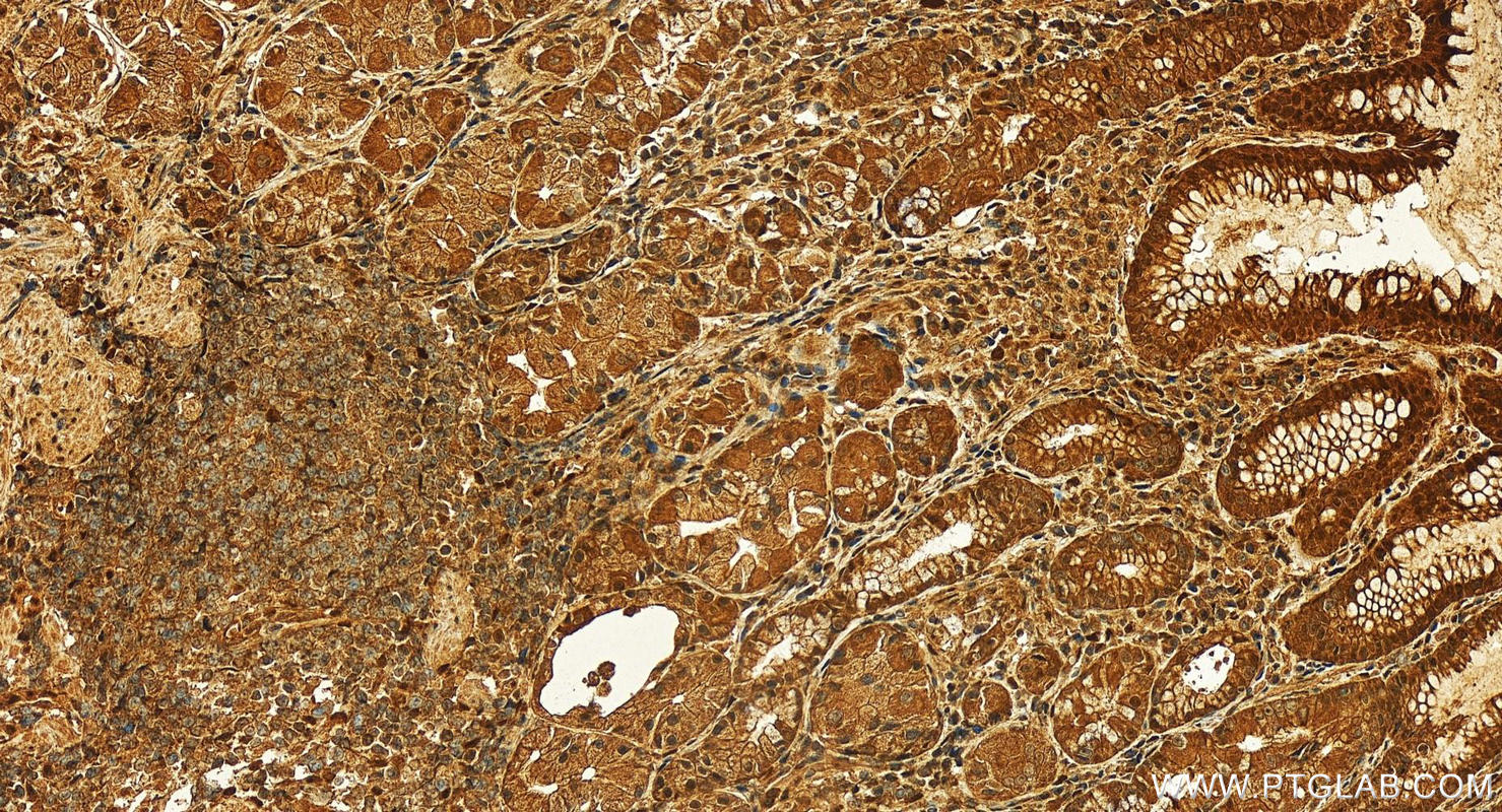 IHC staining of human stomach using 26985-1-AP