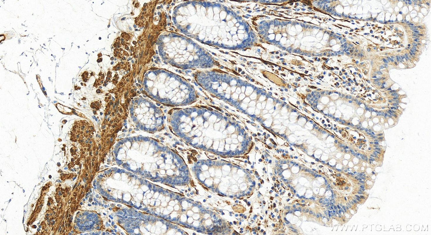 IHC staining of human colon using 24855-1-AP