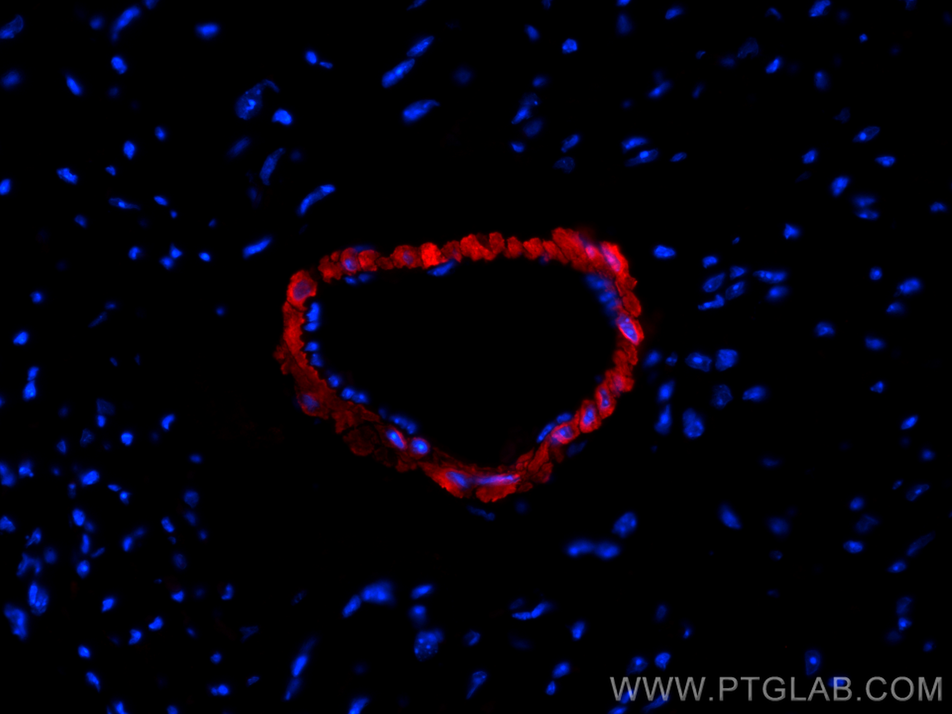 IF Staining of mouse heart using CL594-13938