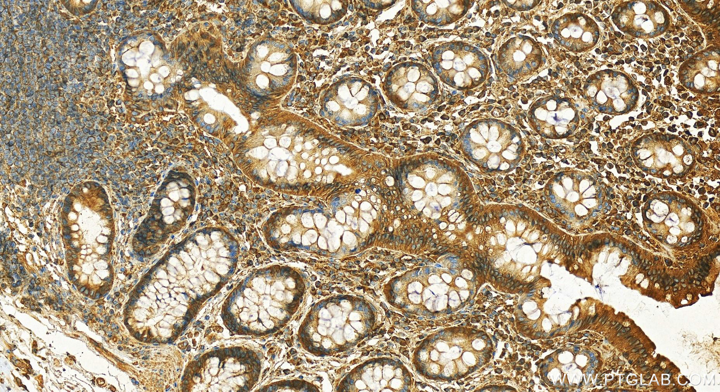 IHC staining of human normal colon using 27298-1-AP