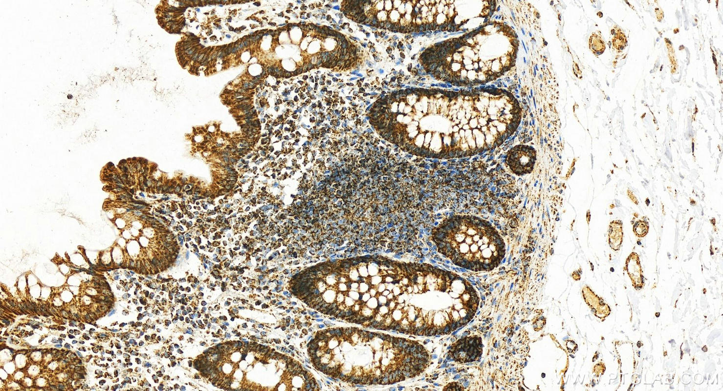 IHC staining of human normal colon using 27298-1-AP