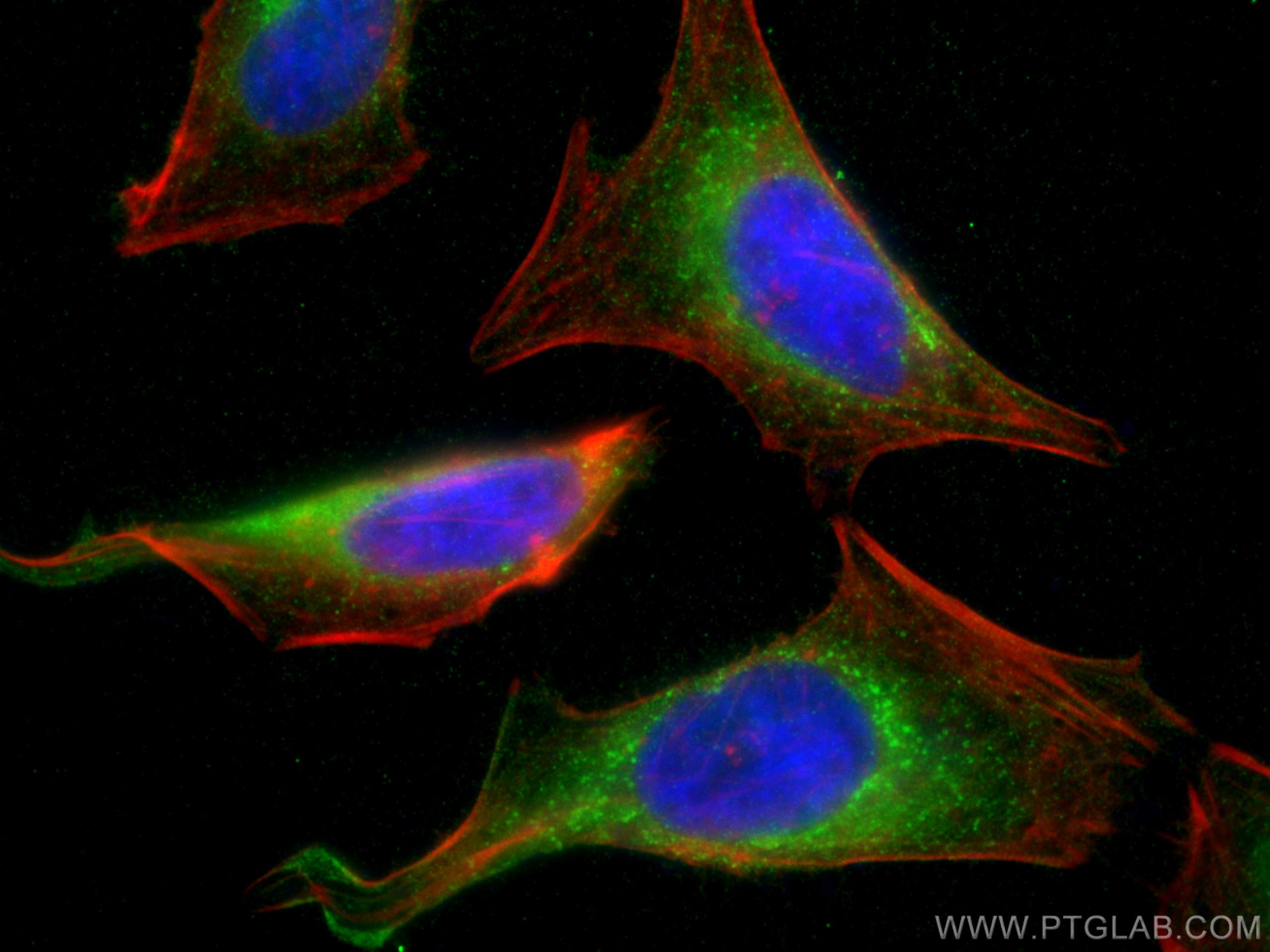 IF Staining of HeLa using 67585-1-Ig (same clone as 67585-1-PBS)