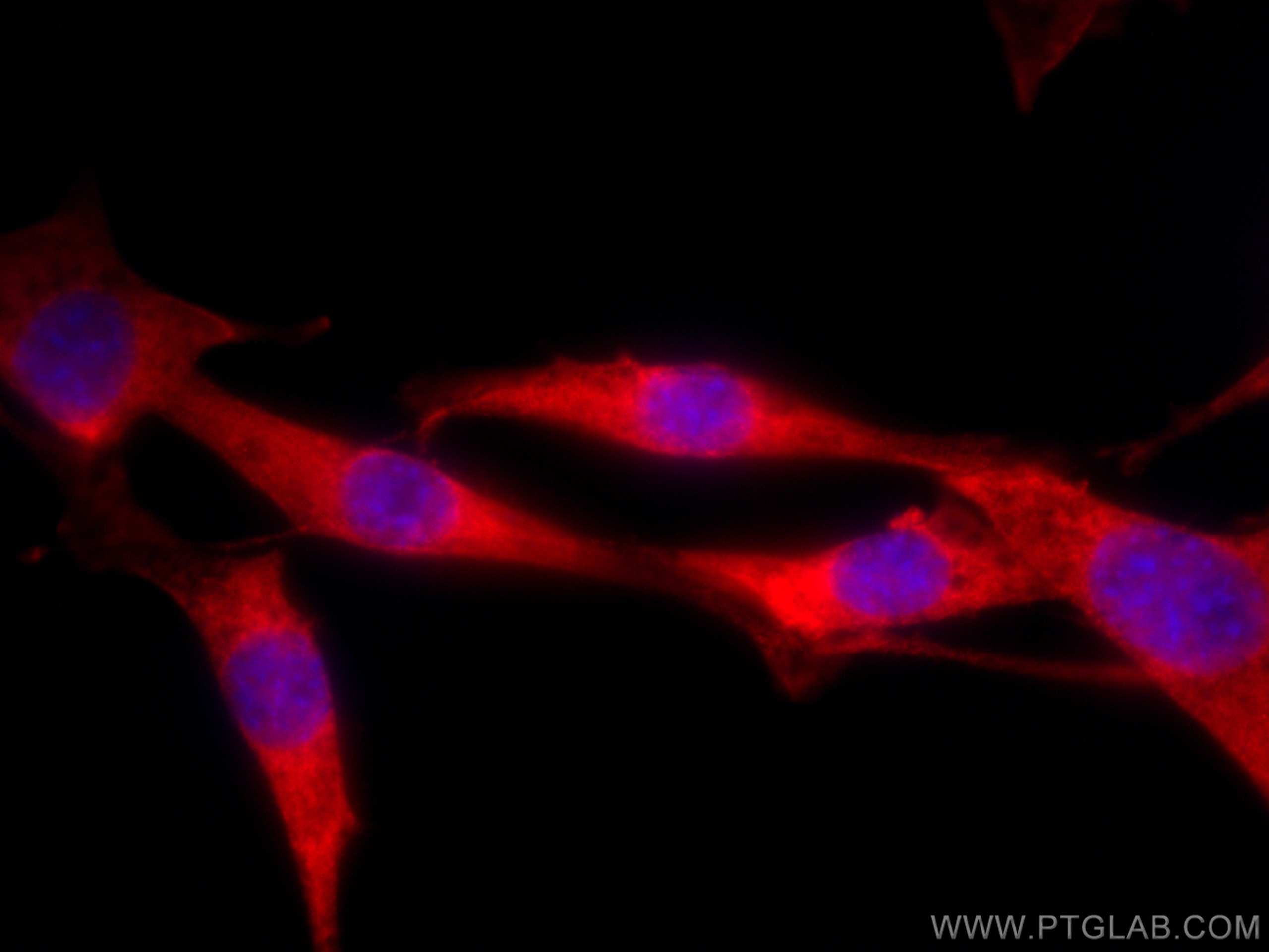 IF Staining of NIH/3T3 using CL594-19677