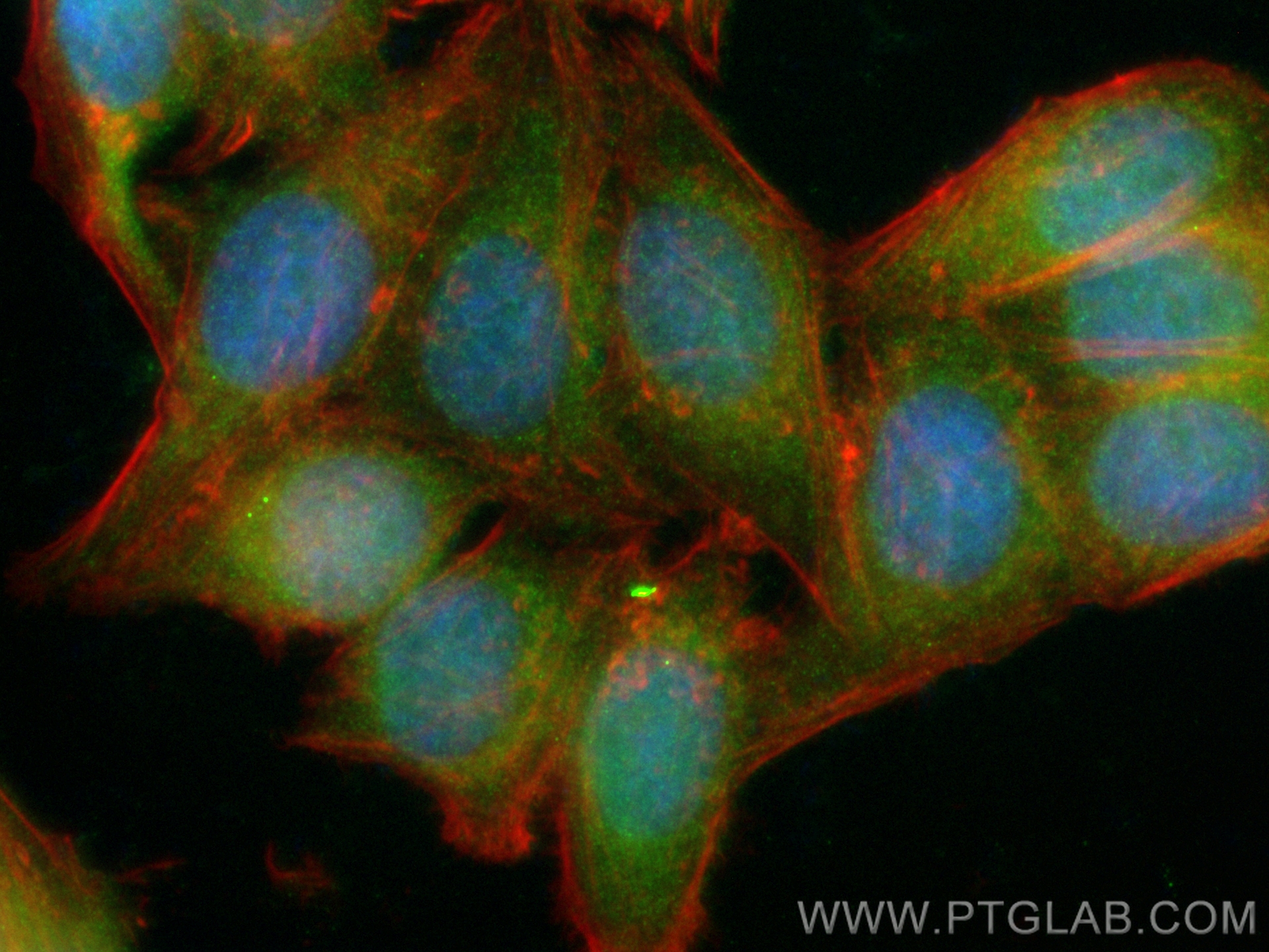 Caspase 8/p43/p18