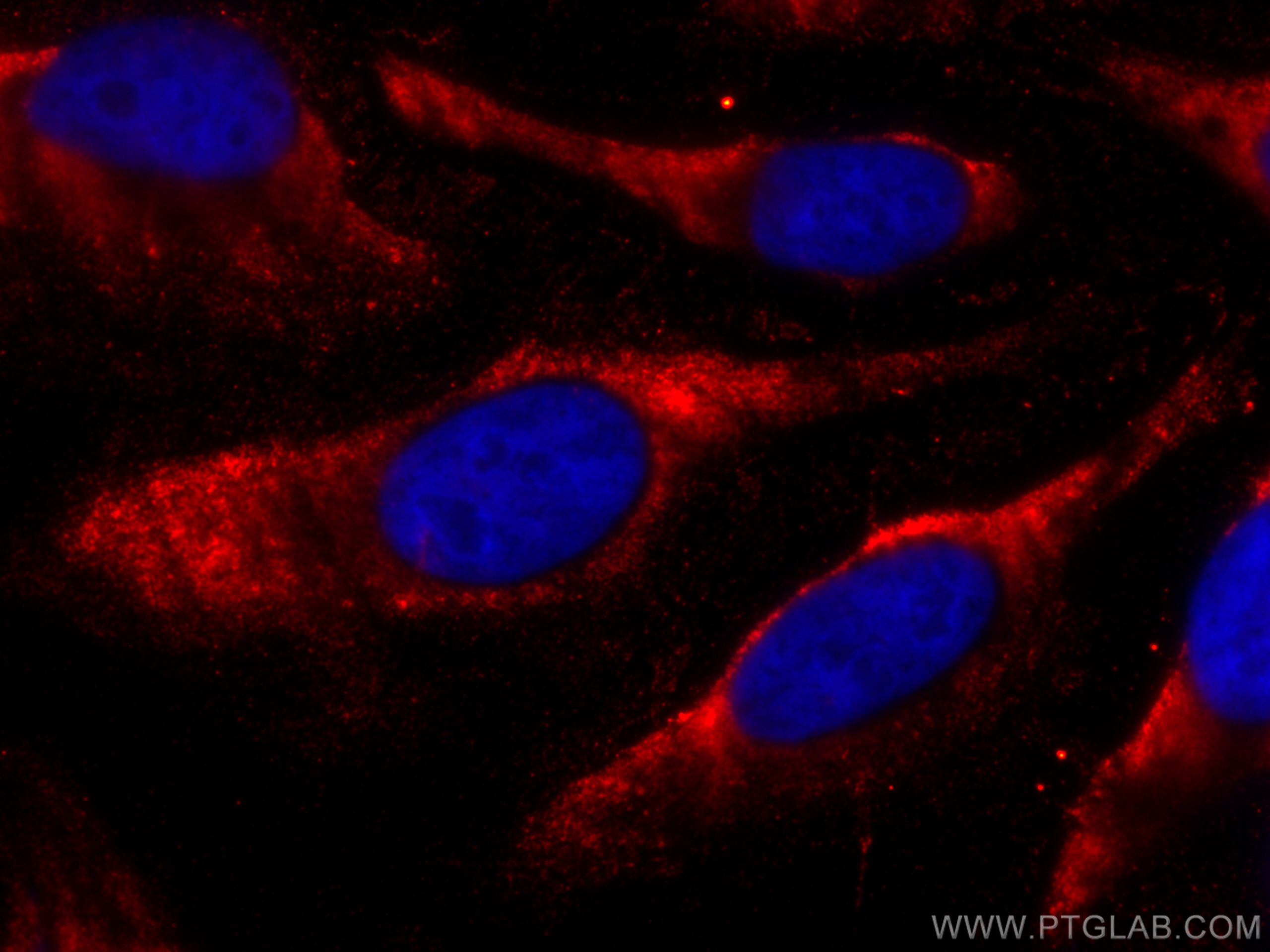 IF Staining of HeLa using CL594-66093