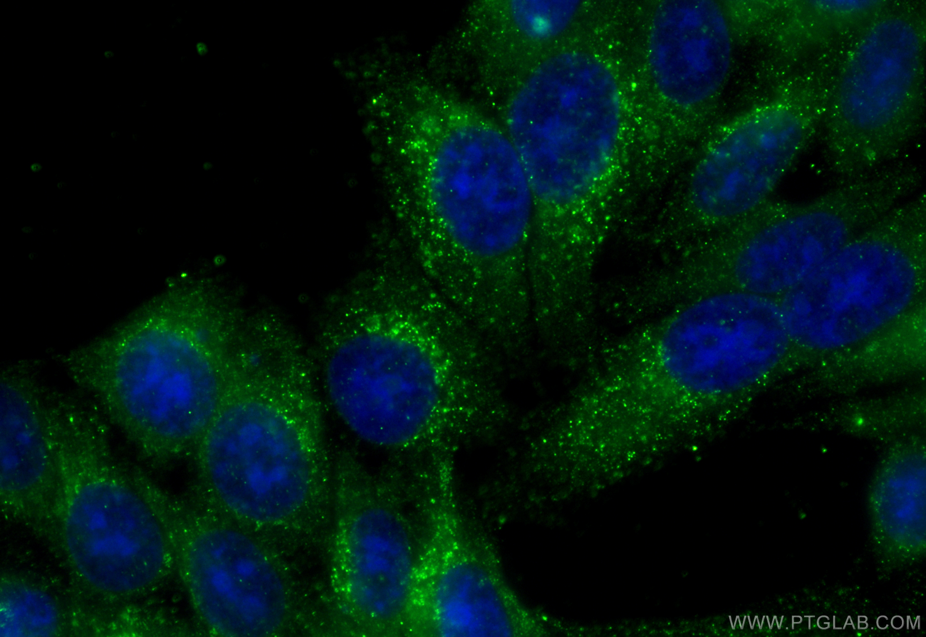 IF Staining of HepG2 using 66765-1-Ig