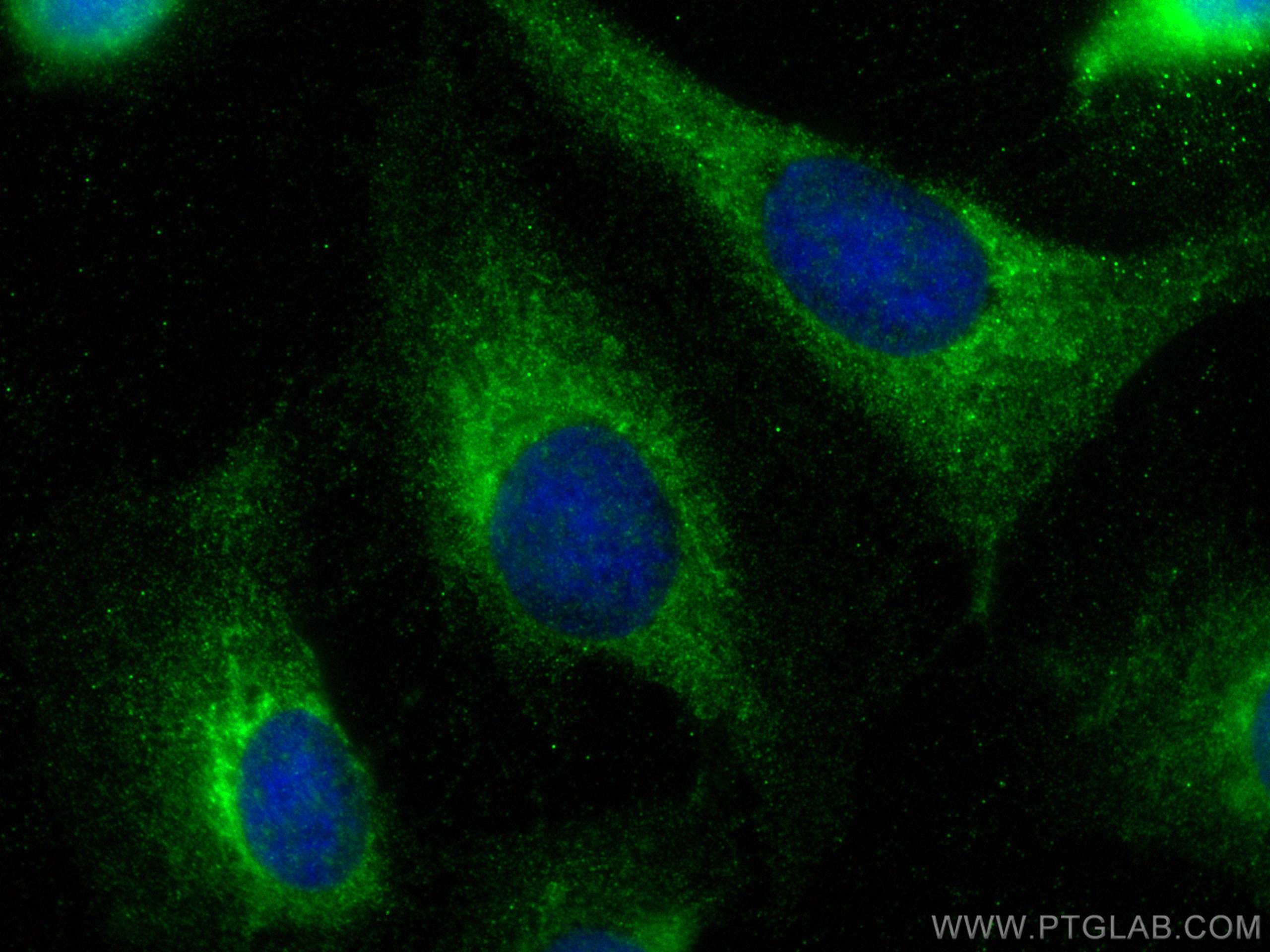 IF Staining of U2OS using 30790-1-AP