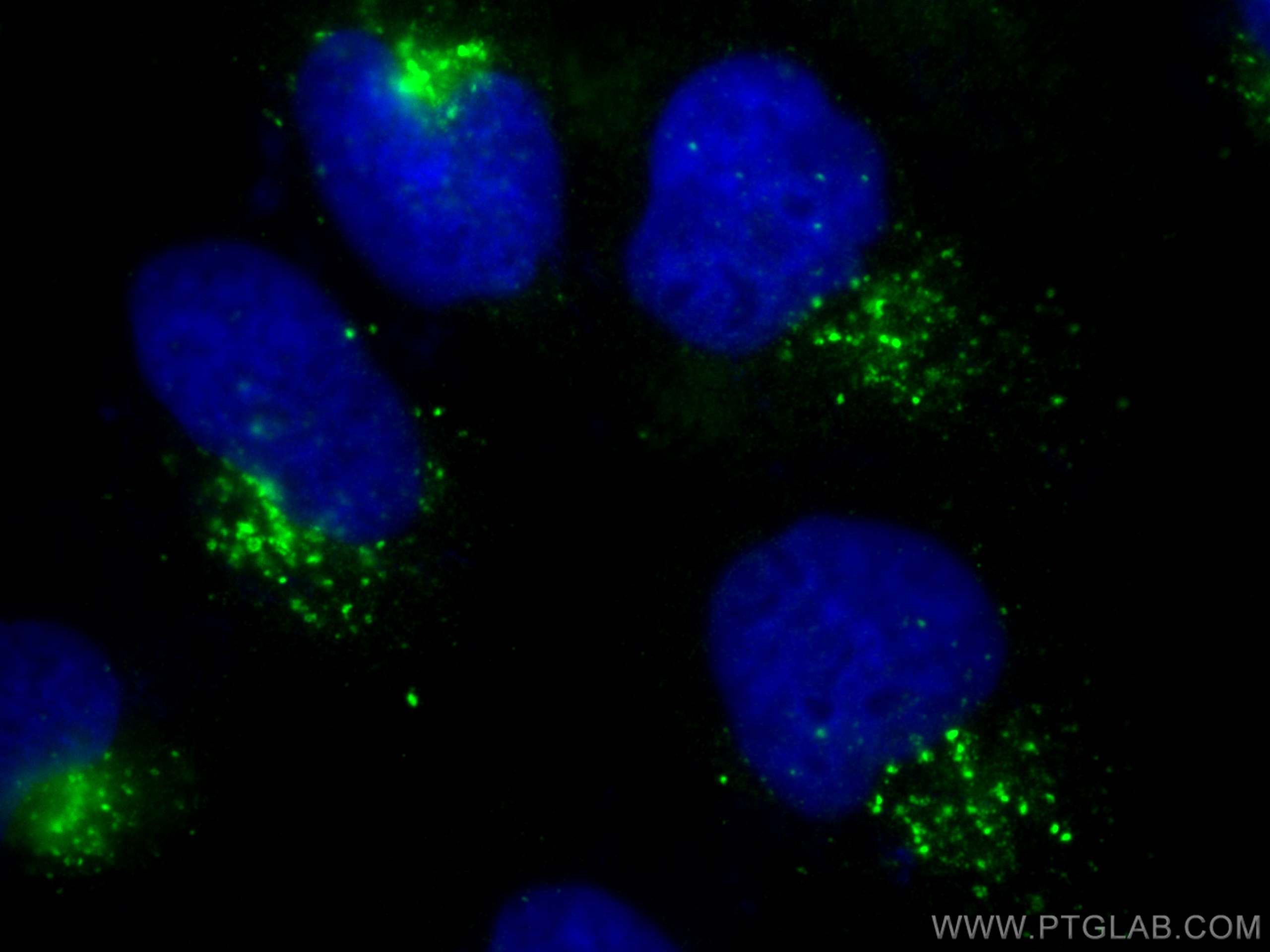 IF Staining of A431 using 31516-1-AP