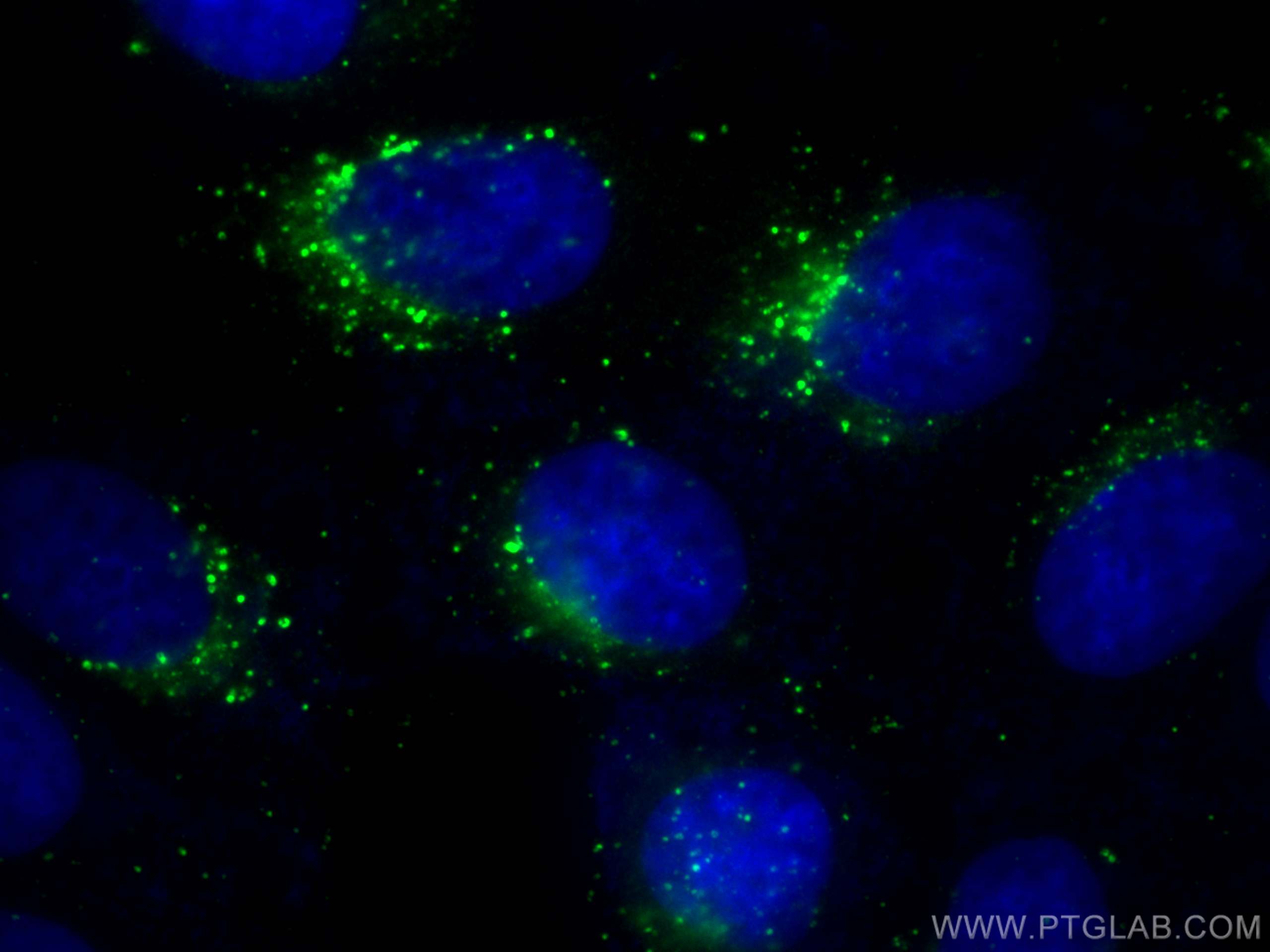 IF Staining of MCF-7 using 31516-1-AP