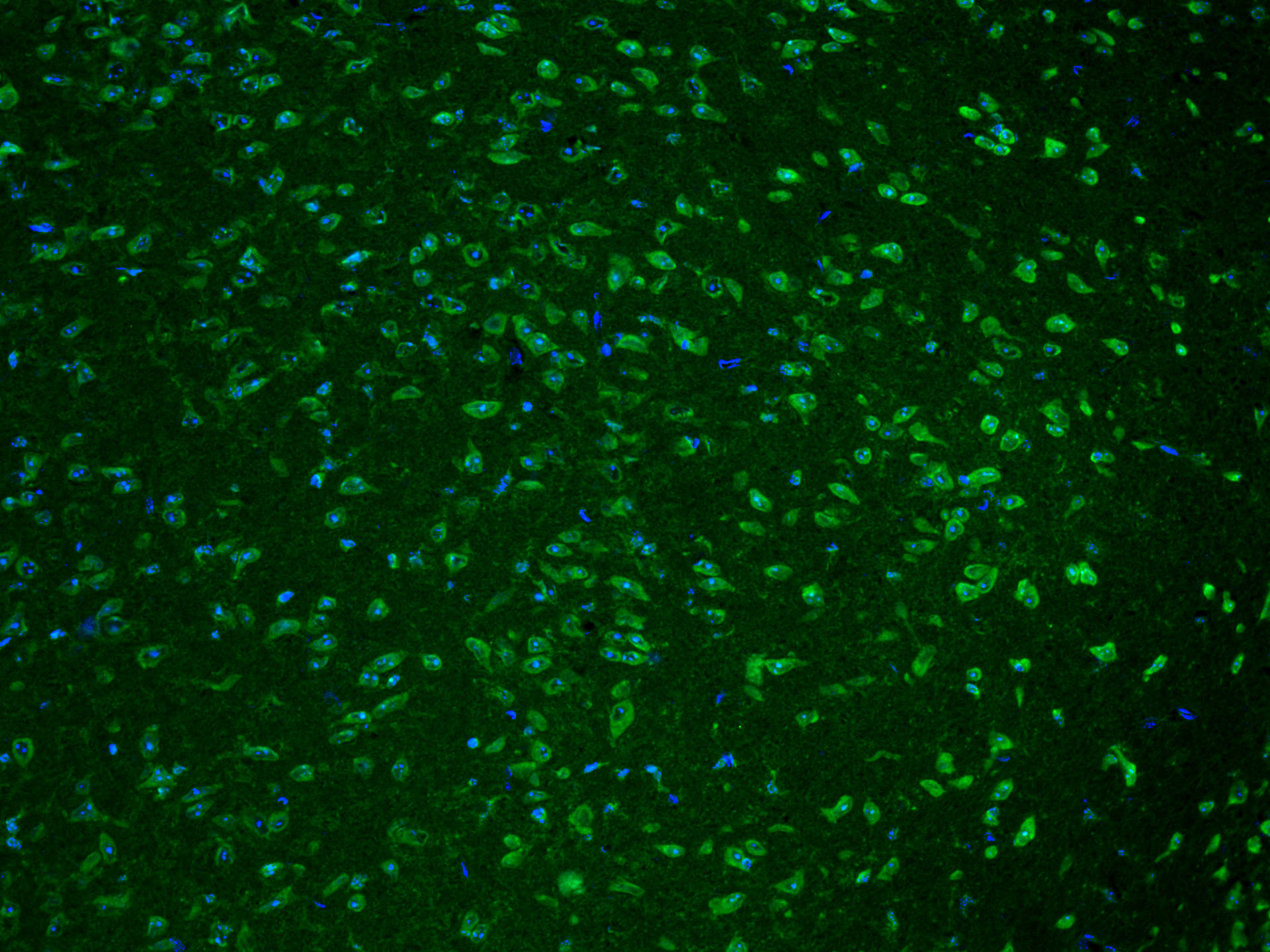 IF Staining of mouse brain using CL488-11239