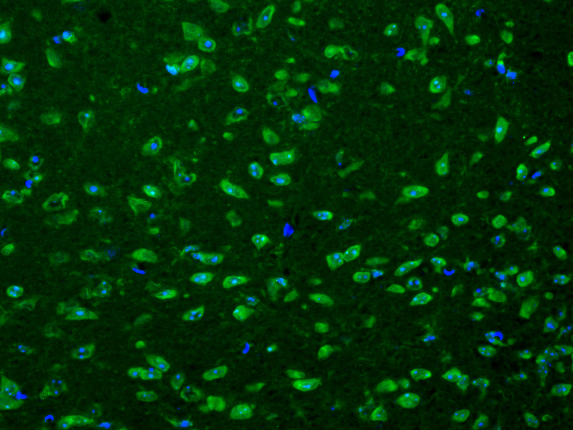 IF Staining of mouse brain using CL488-11239