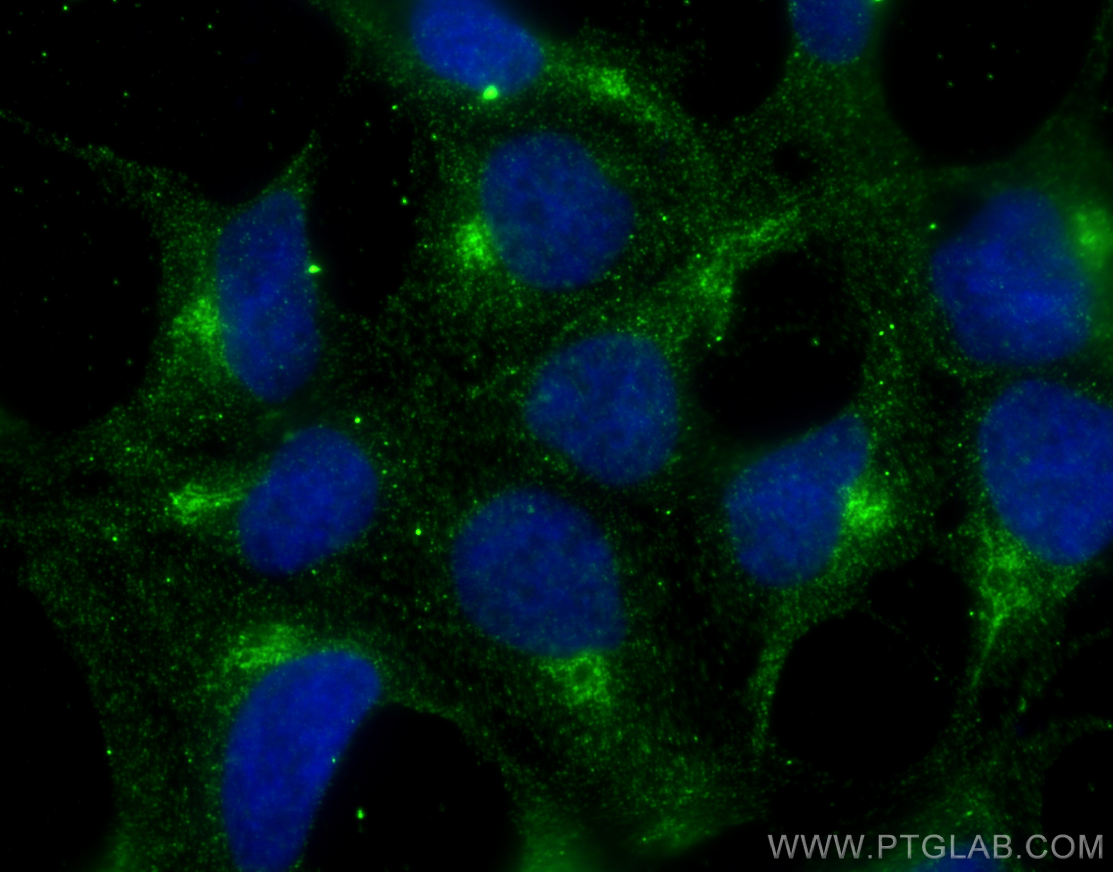 IF Staining of HEK-293 using 66914-1-Ig (same clone as 66914-1-PBS)