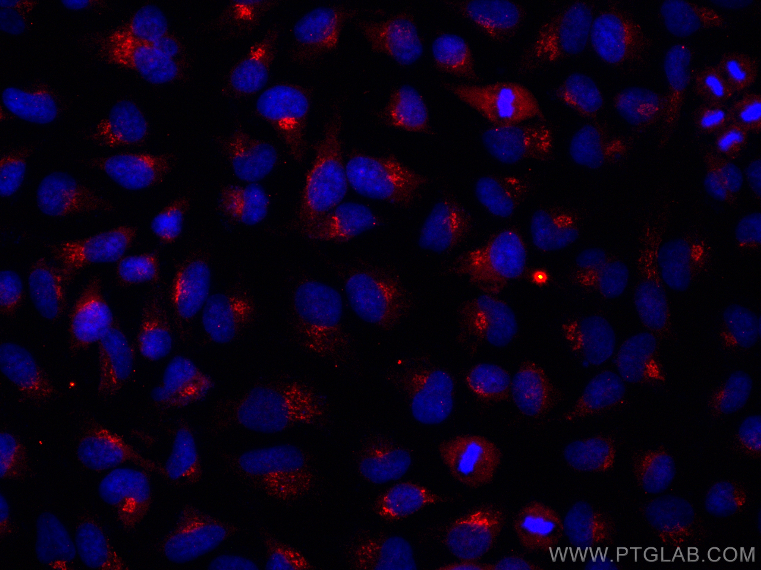 IF Staining of HeLa using CL594-66914