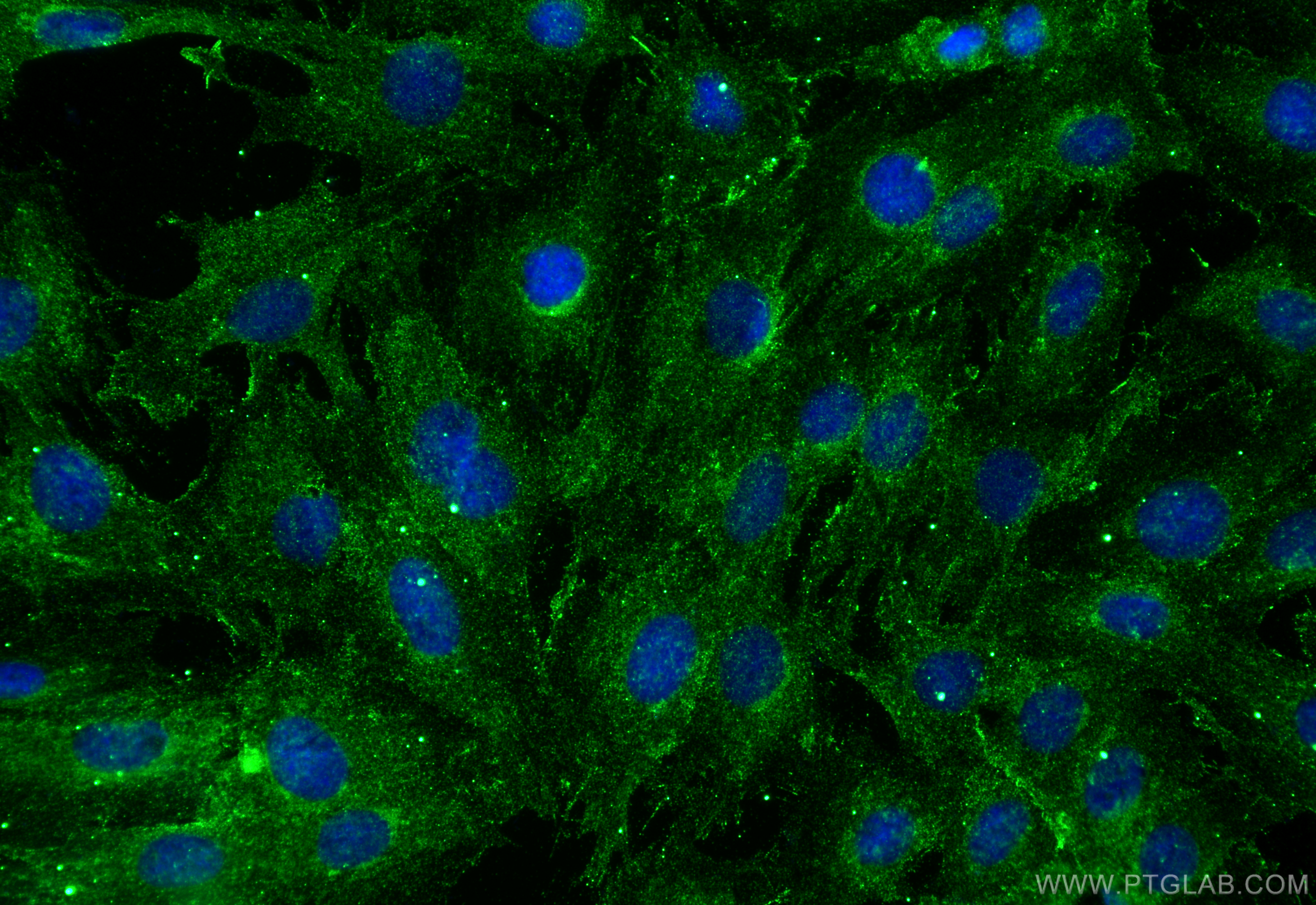 IF Staining of H9C2 using 28358-1-AP