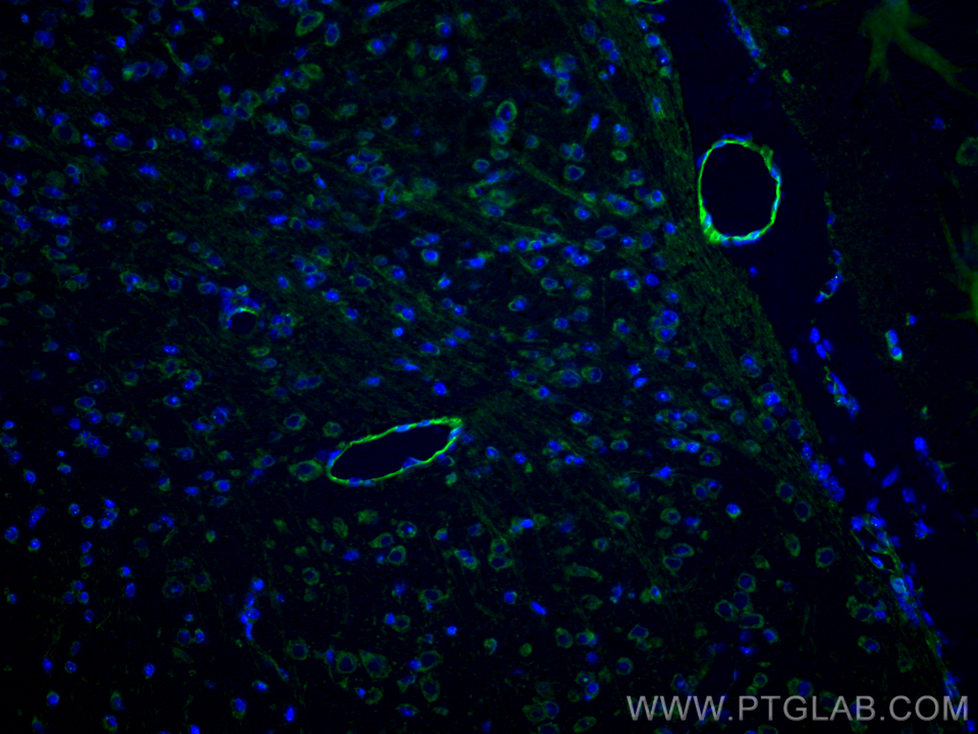 IF Staining of mouse brain using 28083-1-AP