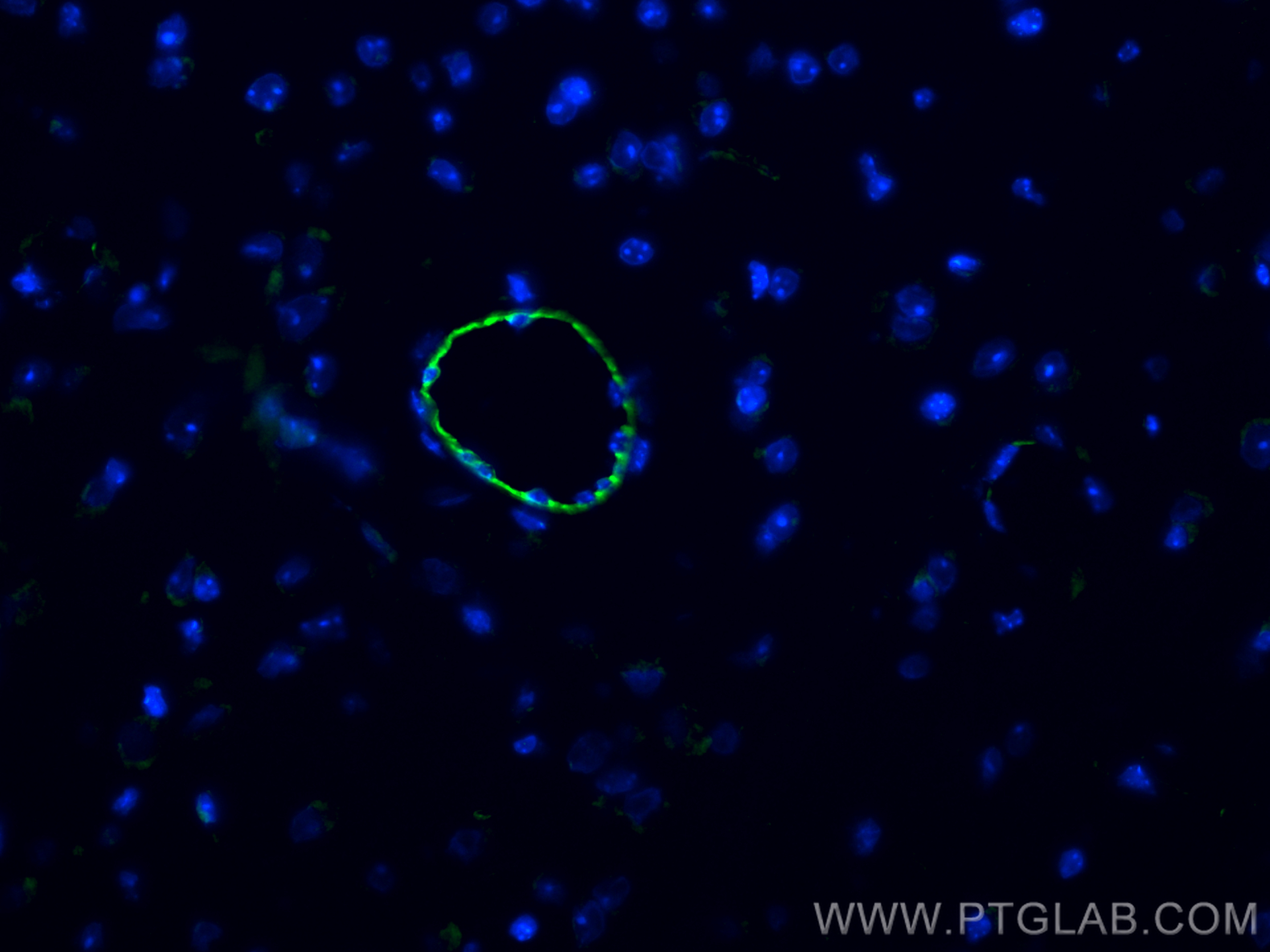 IF Staining of mouse brain using 28083-1-AP