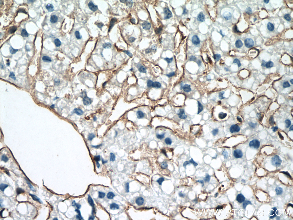 Antibody Combinations For Optimized Staining Of Macro - vrogue.co