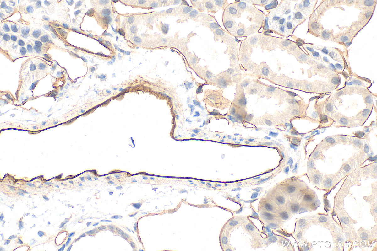 IHC staining of mouse kidney using 28083-1-AP